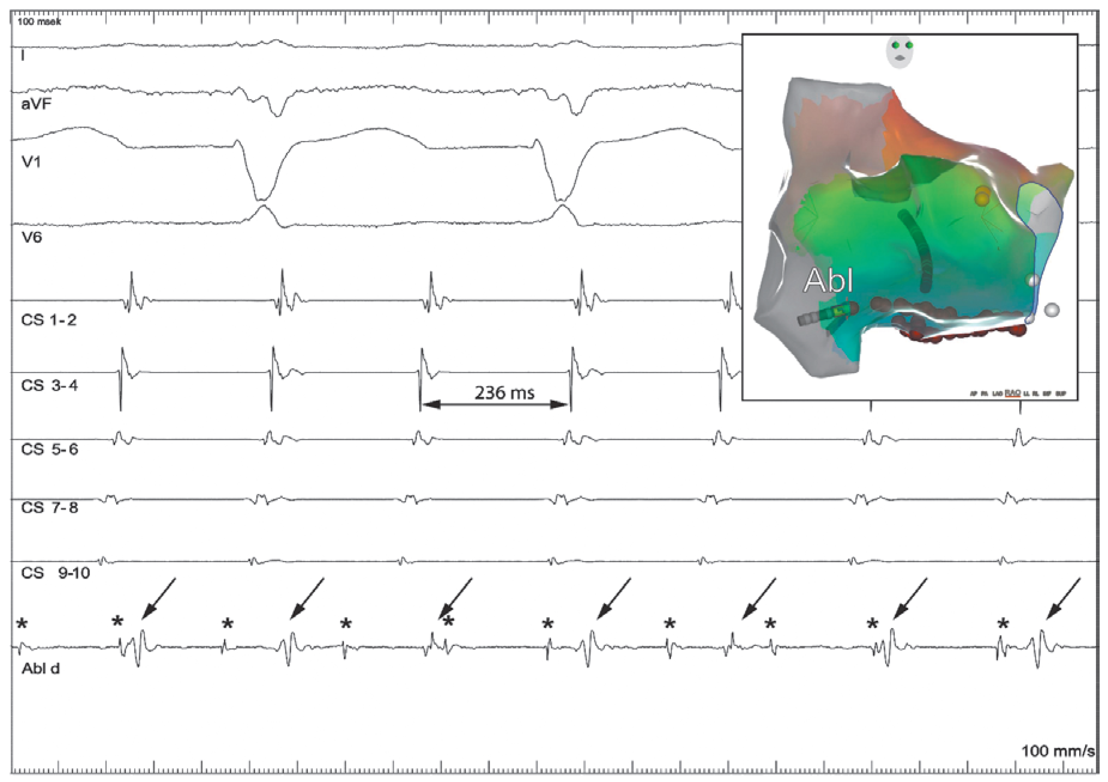 Cardiovascmed 21 00296 g002 Cardiovascmed 21 00296 g002