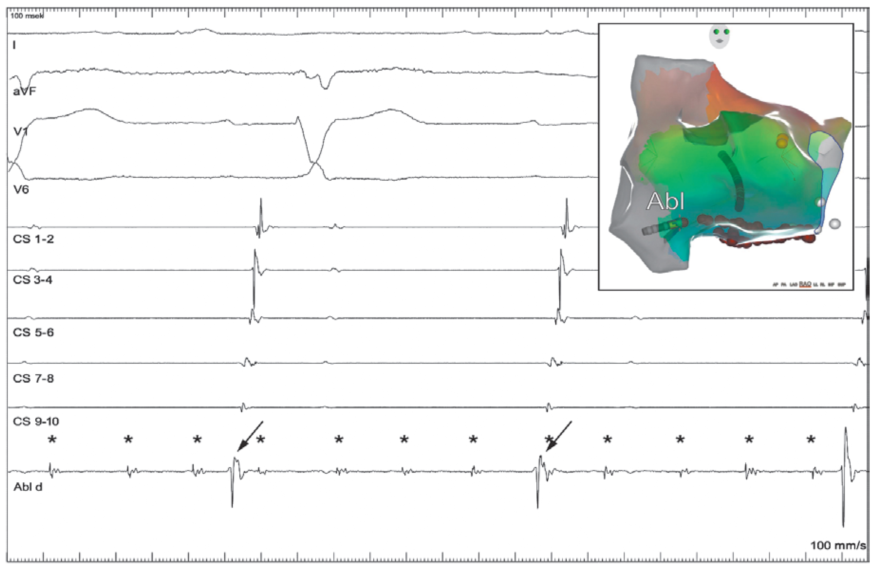 Cardiovascmed 21 00296 g003 Cardiovascmed 21 00296 g003