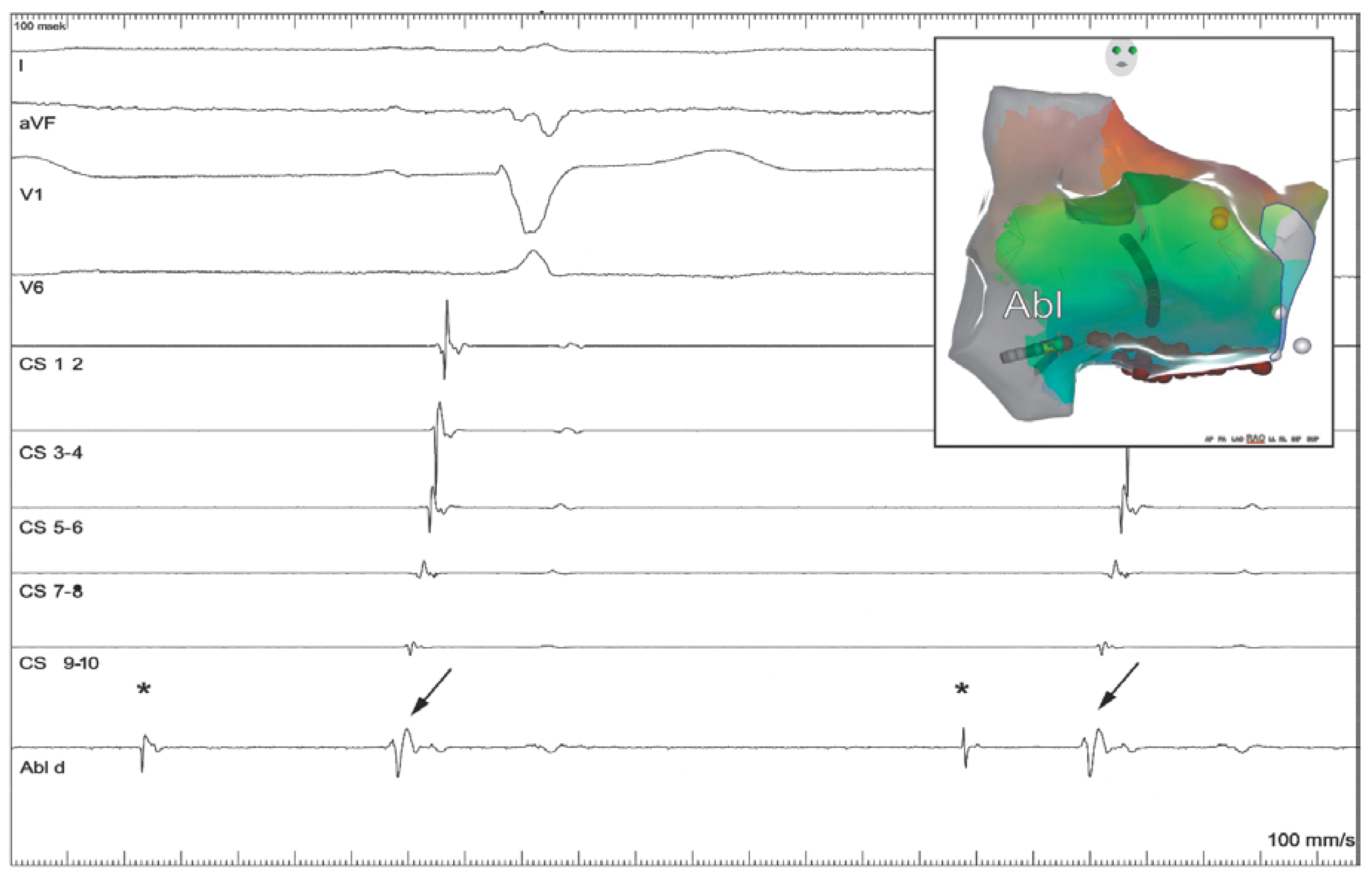 Cardiovascmed 21 00296 g004 Cardiovascmed 21 00296 g004