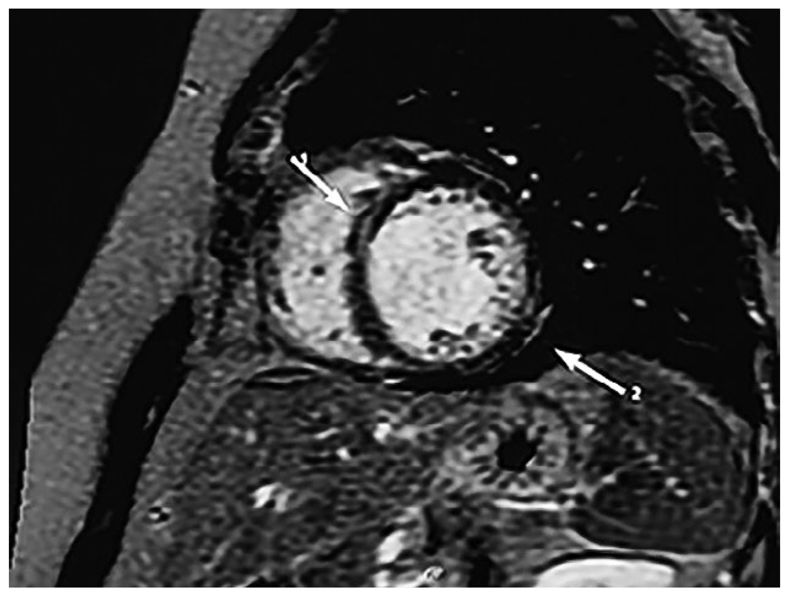 Cardiovascmed 21 00316 g001 Cardiovascmed 21 00316 g001