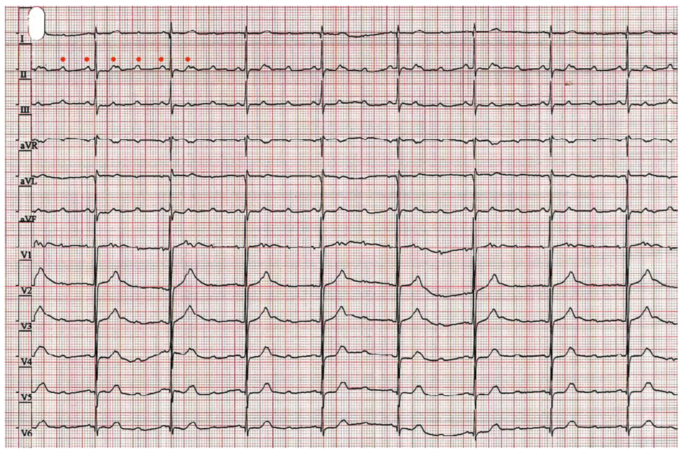 Cardiovascmed 21 00322 g002