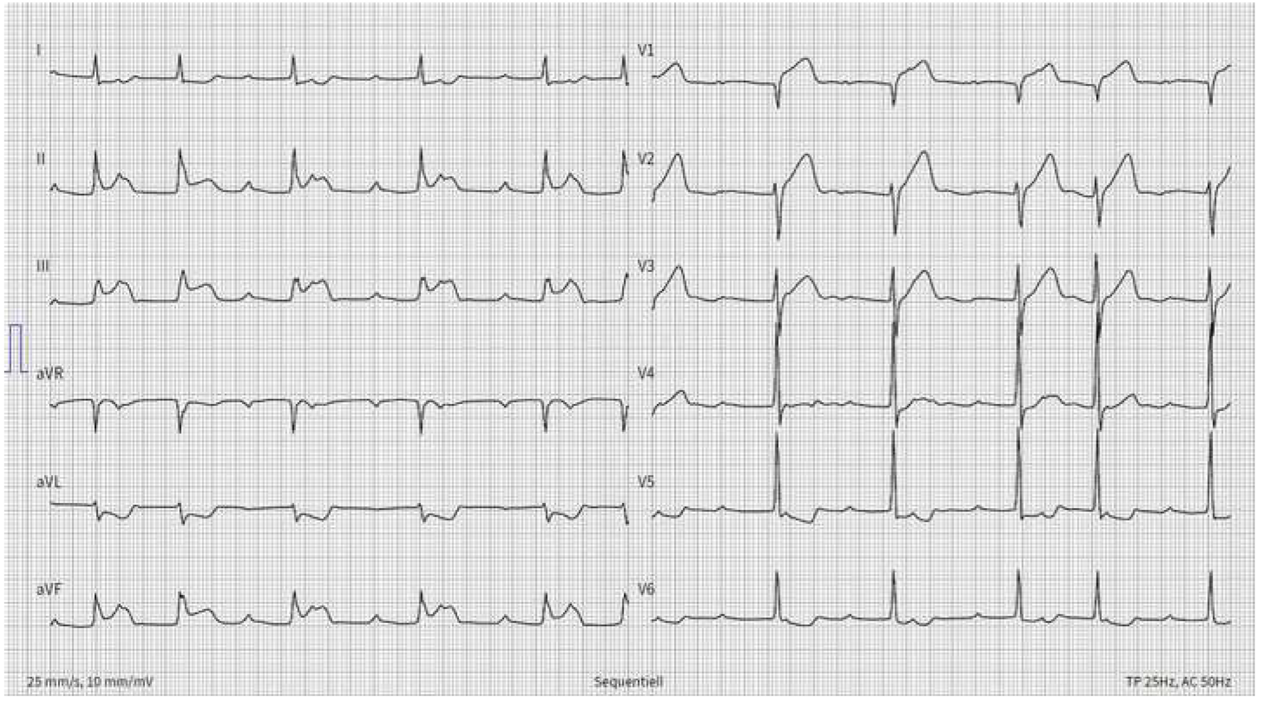 Cardiovascmed 22 00001 g002