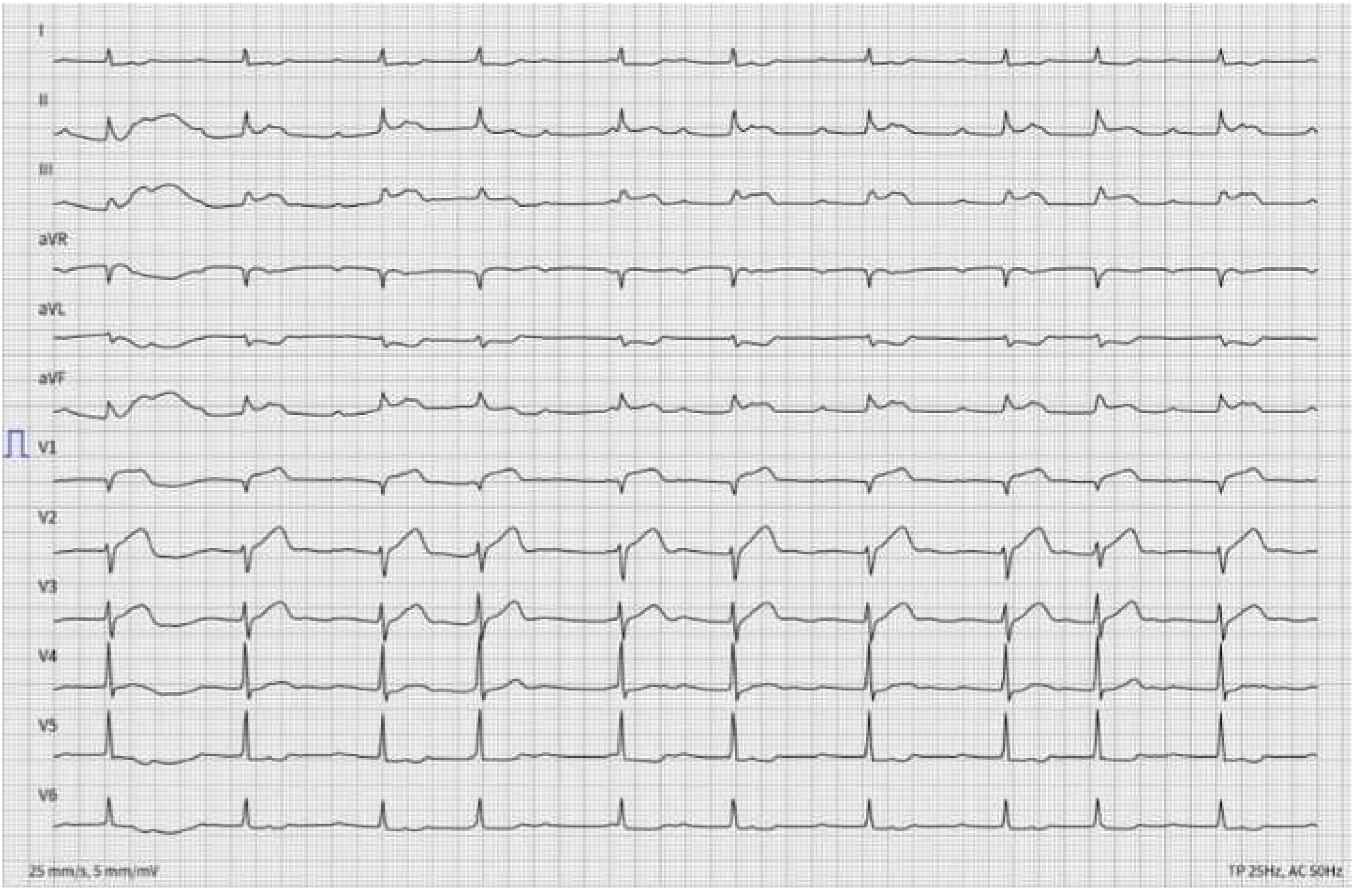 Cardiovascmed 22 00001 g003
