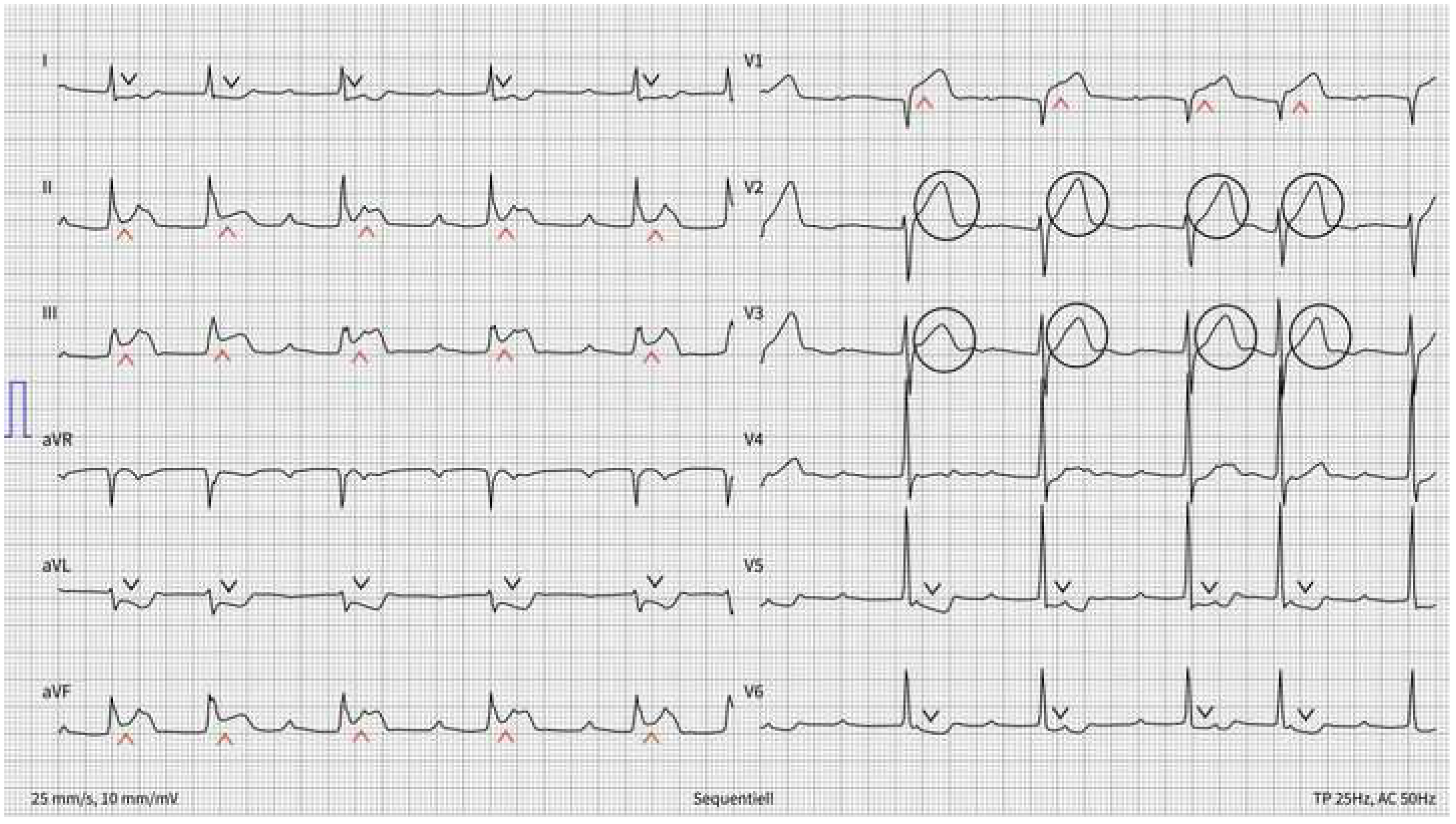 Cardiovascmed 22 00001 g004