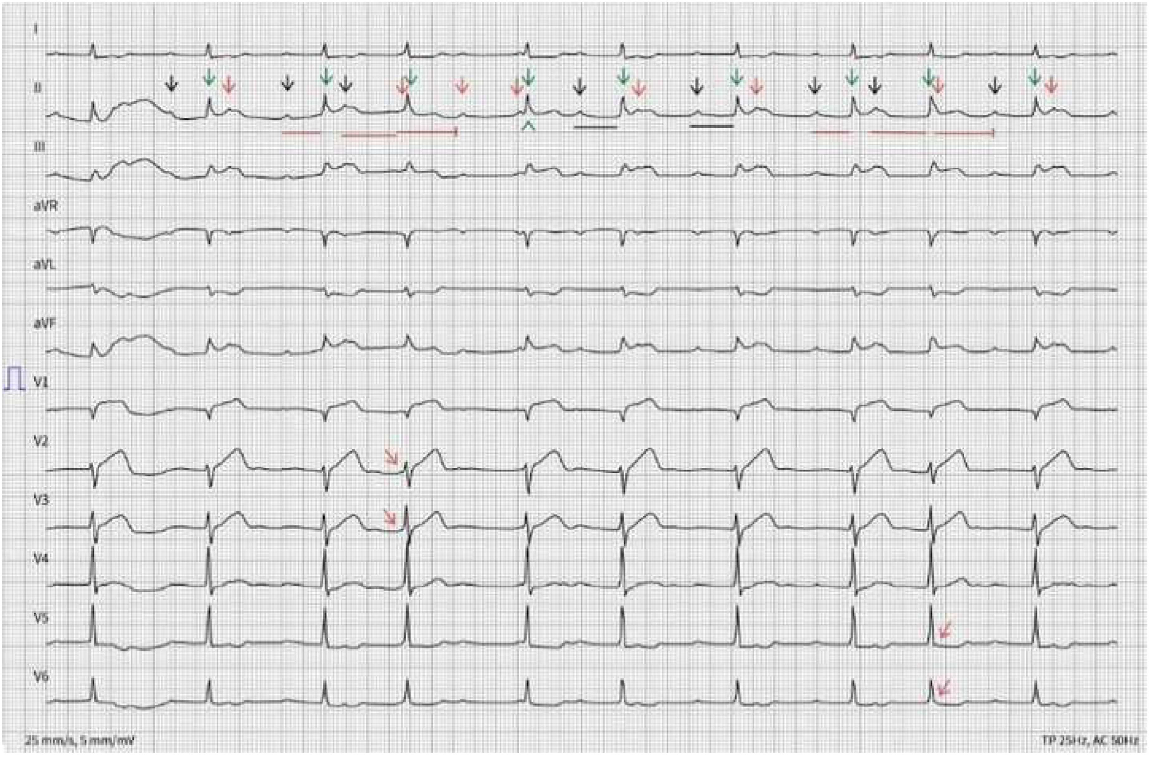Cardiovascmed 22 00001 g005