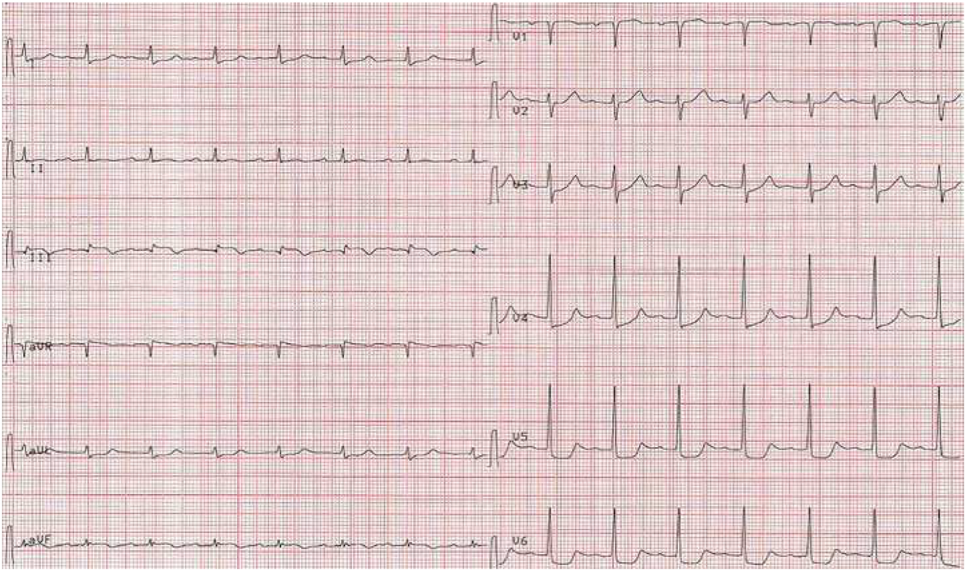 Cardiovascmed 22 00001 g006