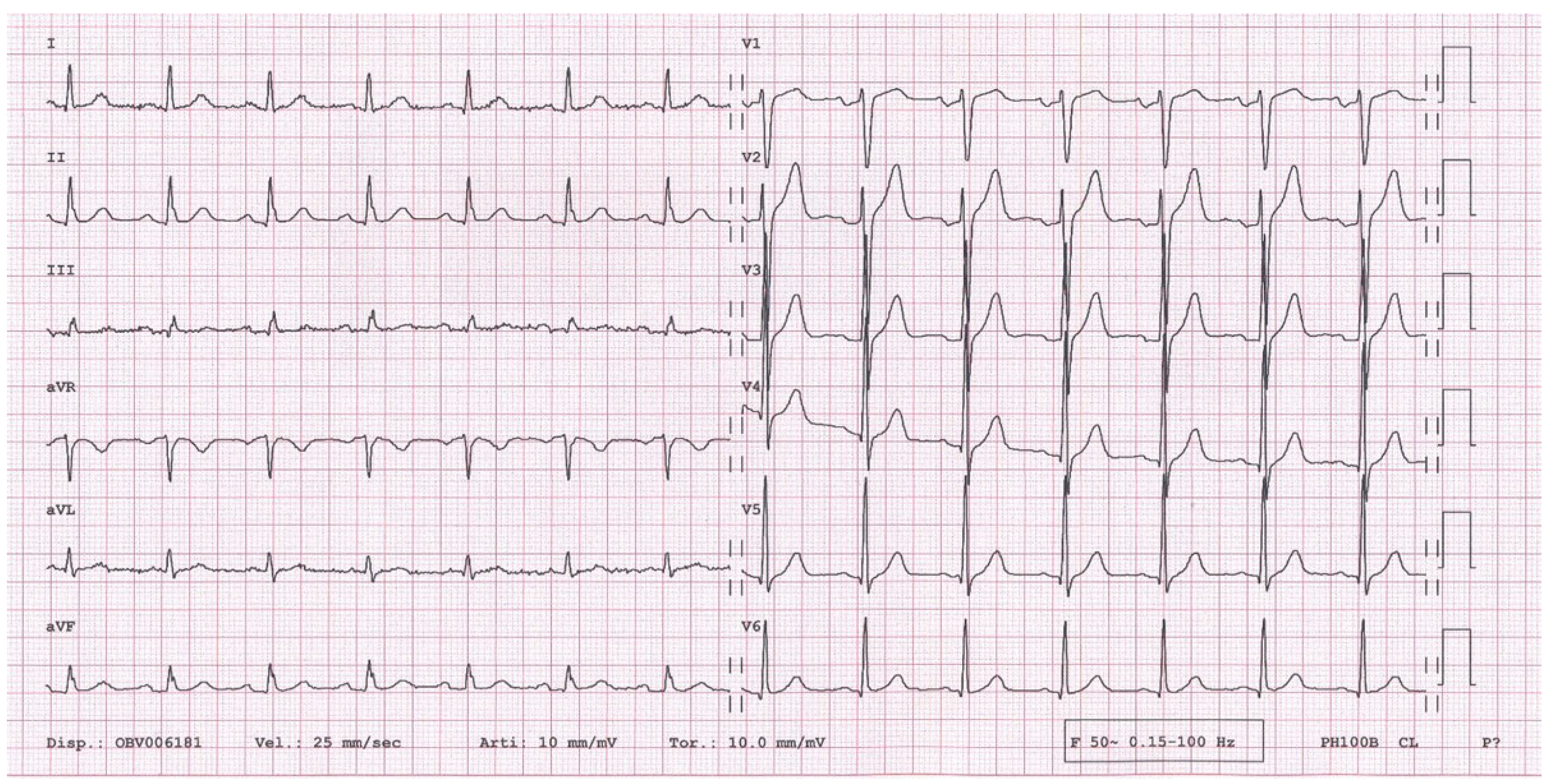 Cardiovascmed 22 w02007 g002