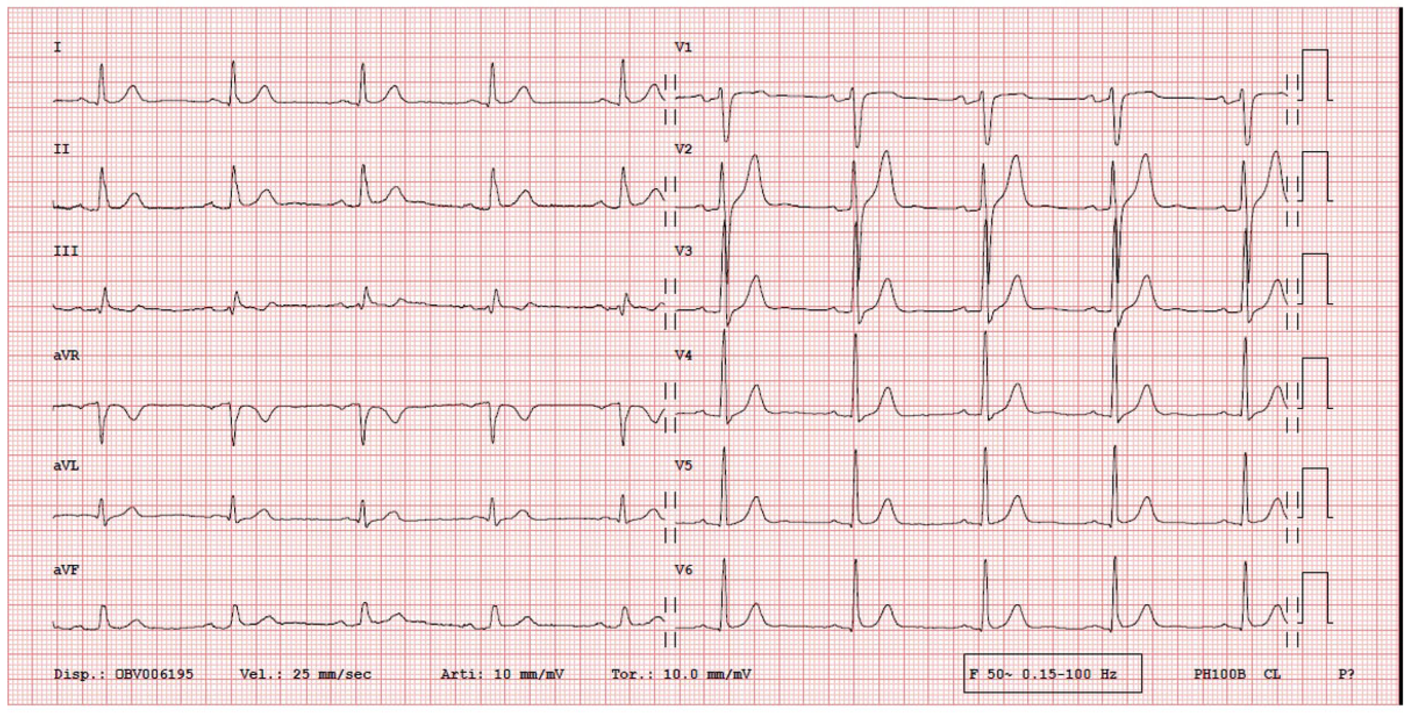 Cardiovascmed 22 w02007 g003