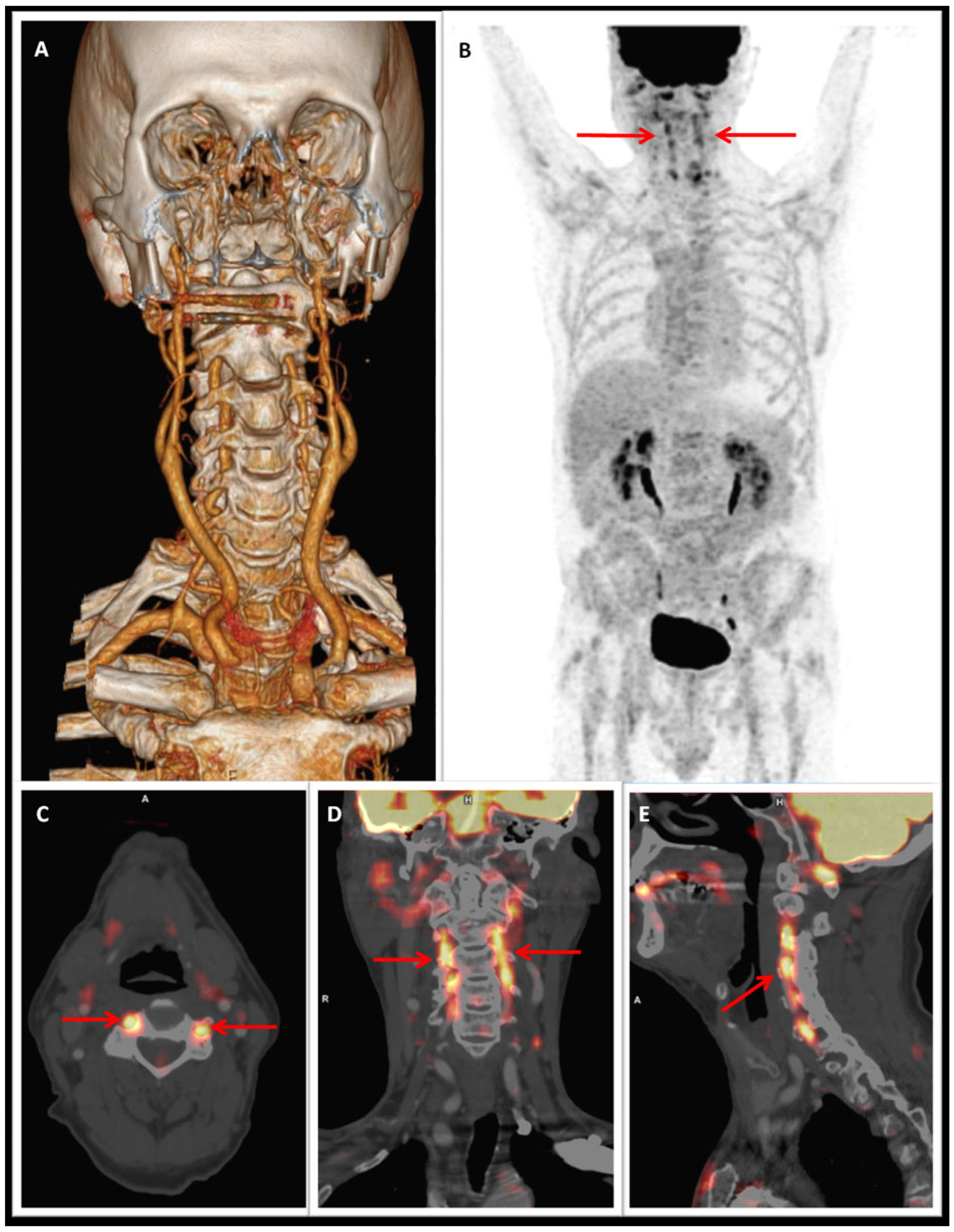 Cardiovascmed 22 w02011 g001 Cardiovascmed 22 w02011 g001