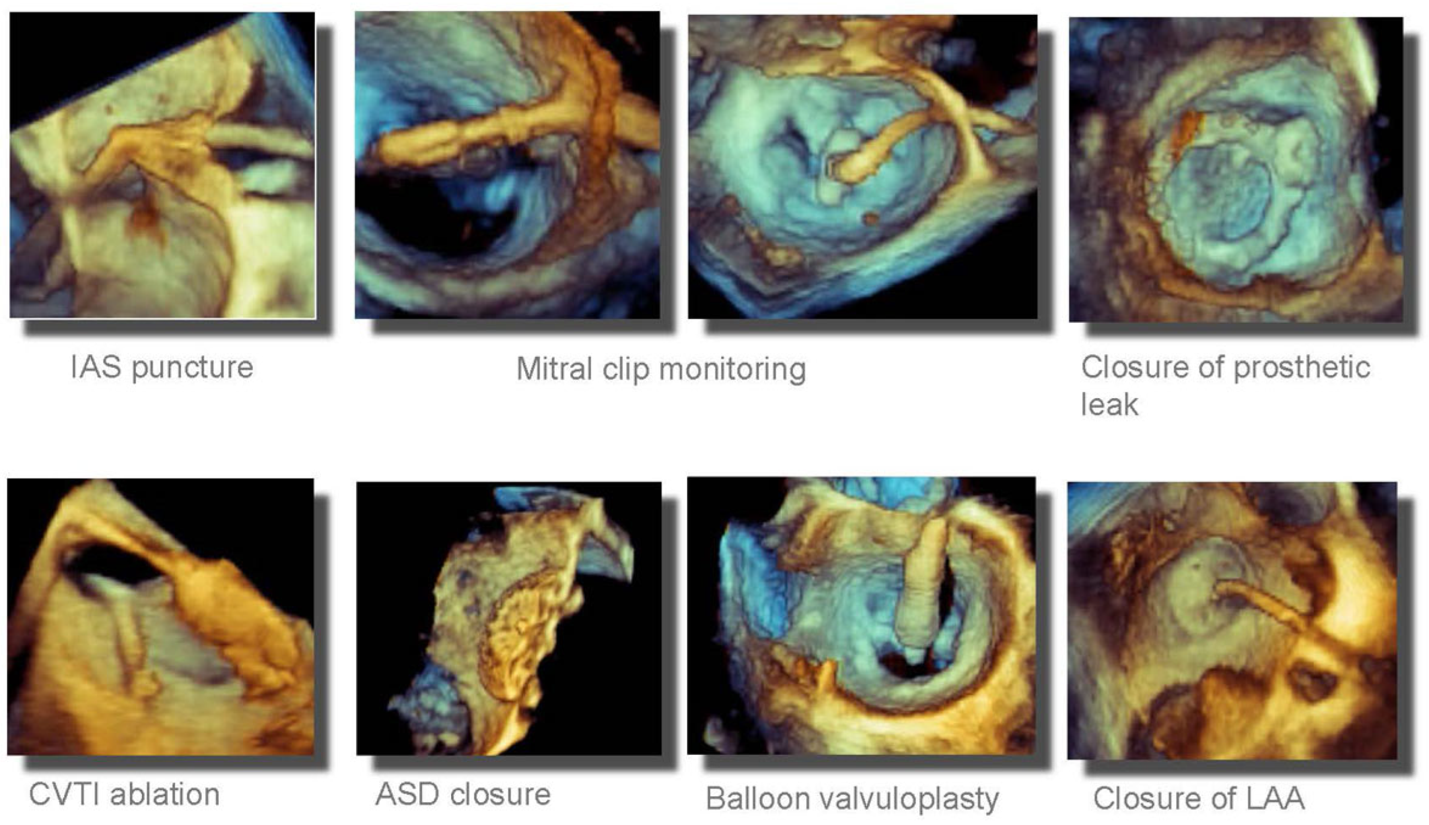 Cardiovascmed 22 w02012 g003 Cardiovascmed 22 w02012 g003