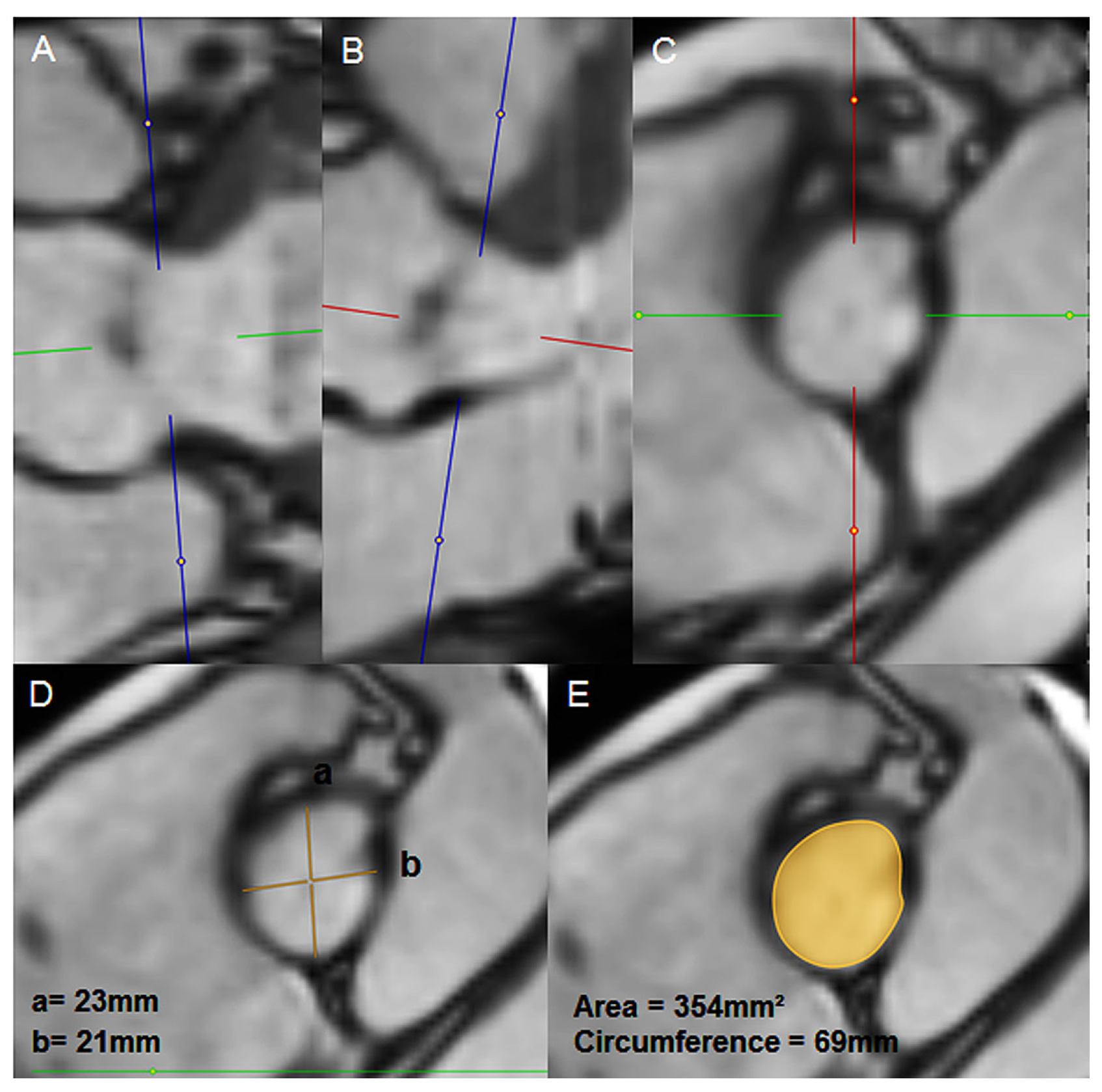 Cardiovascmed 22 w02021 g001 Cardiovascmed 22 w02021 g001