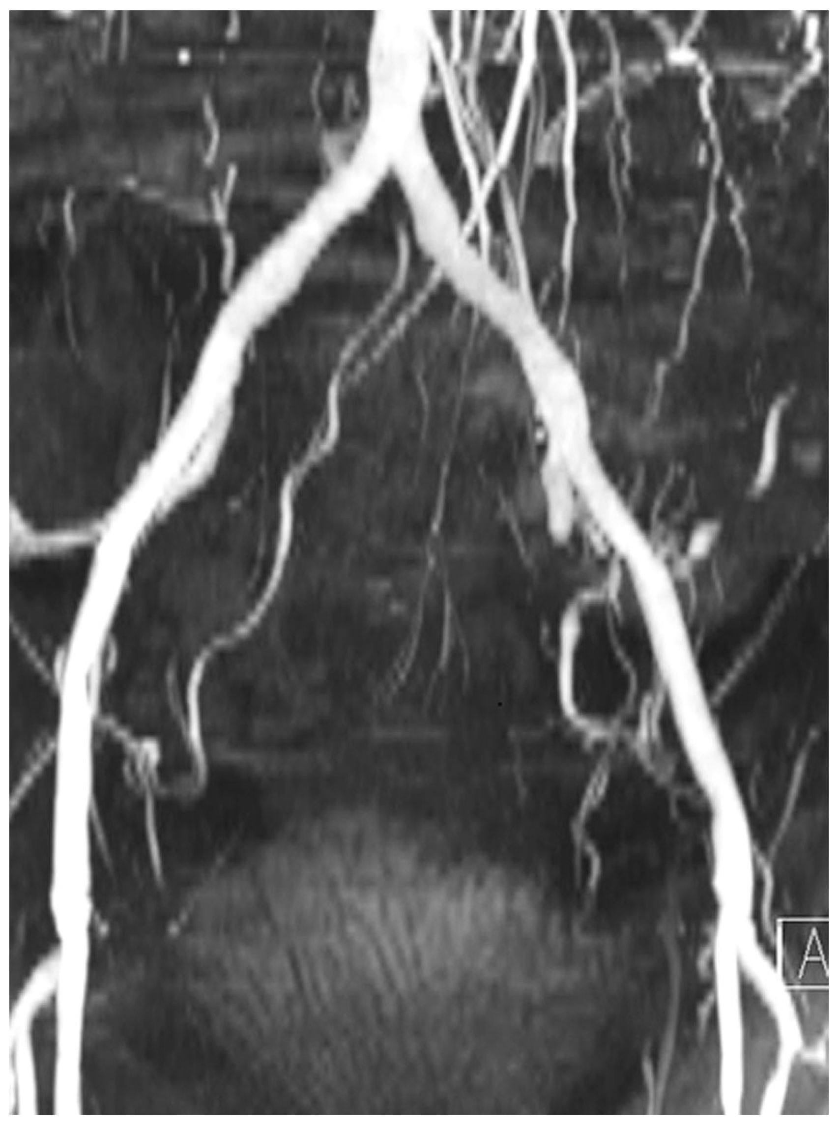 Cardiovascmed 22 w02021 g002 Cardiovascmed 22 w02021 g002