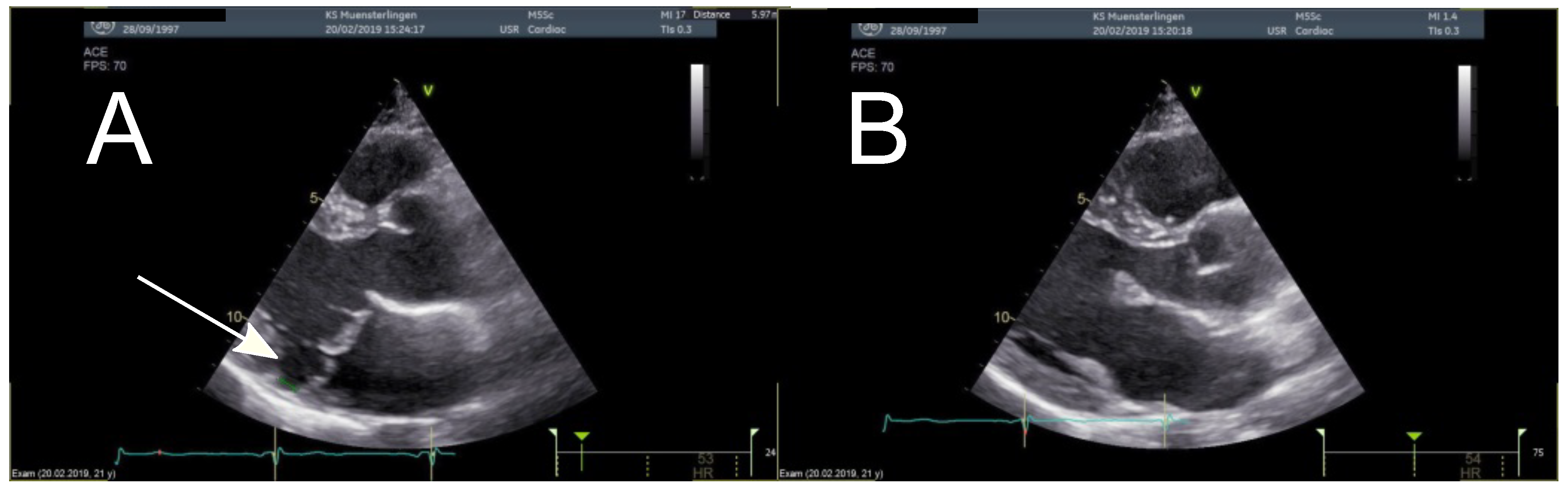 Cardiovascmed 22 w02075 g001 Cardiovascmed 22 w02075 g001