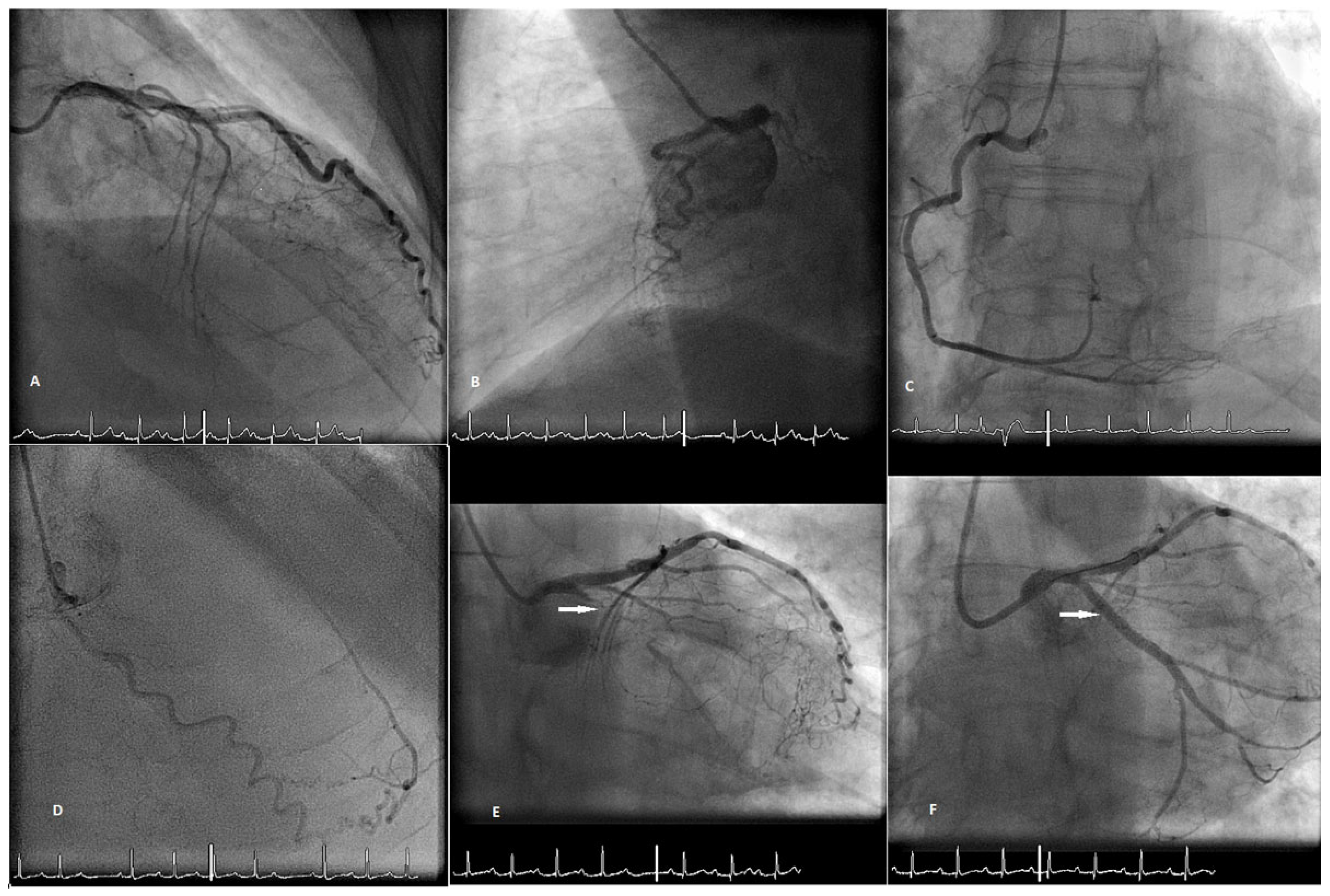 Cardiovascmed 23 w02092 g001 Cardiovascmed 23 w02092 g001