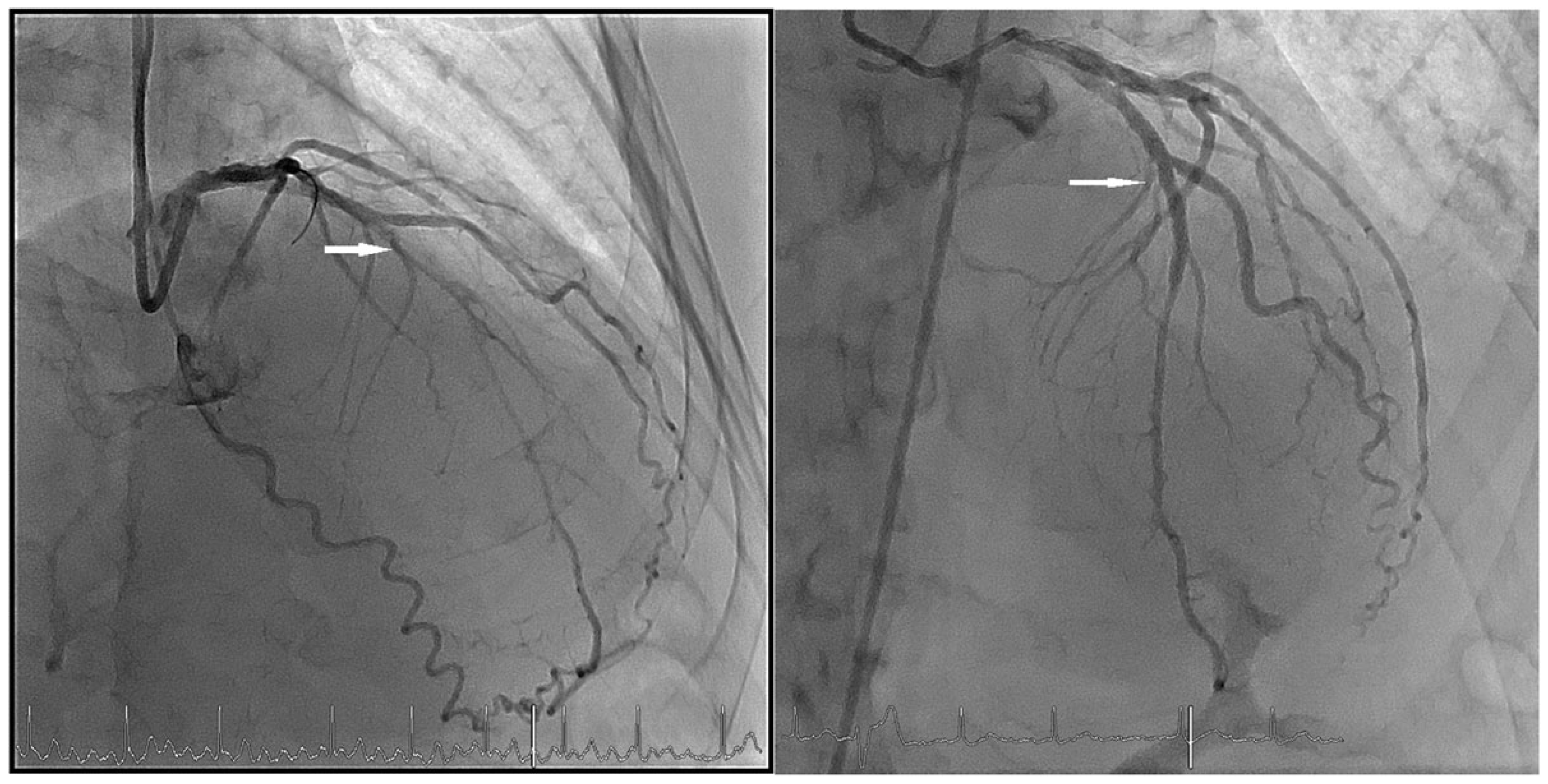 Cardiovascmed 23 w02092 g002 Cardiovascmed 23 w02092 g002