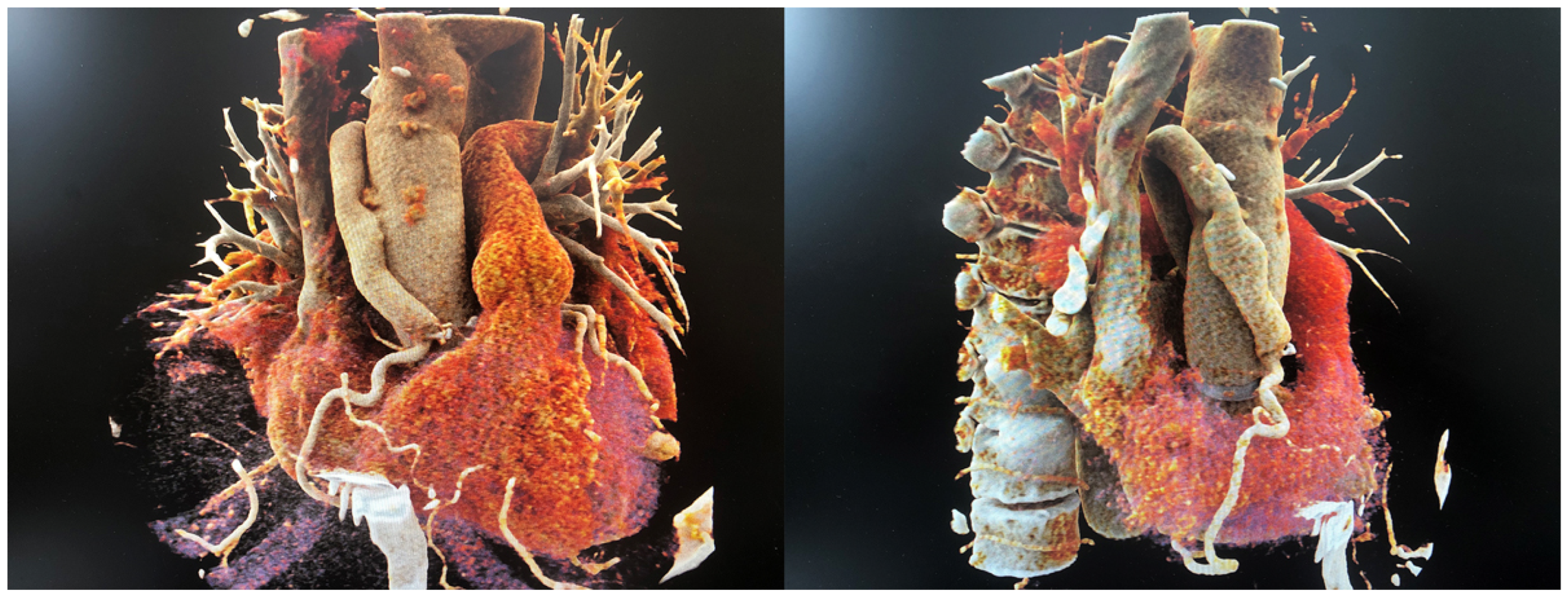 Cardiovascmed 24 00001 g002