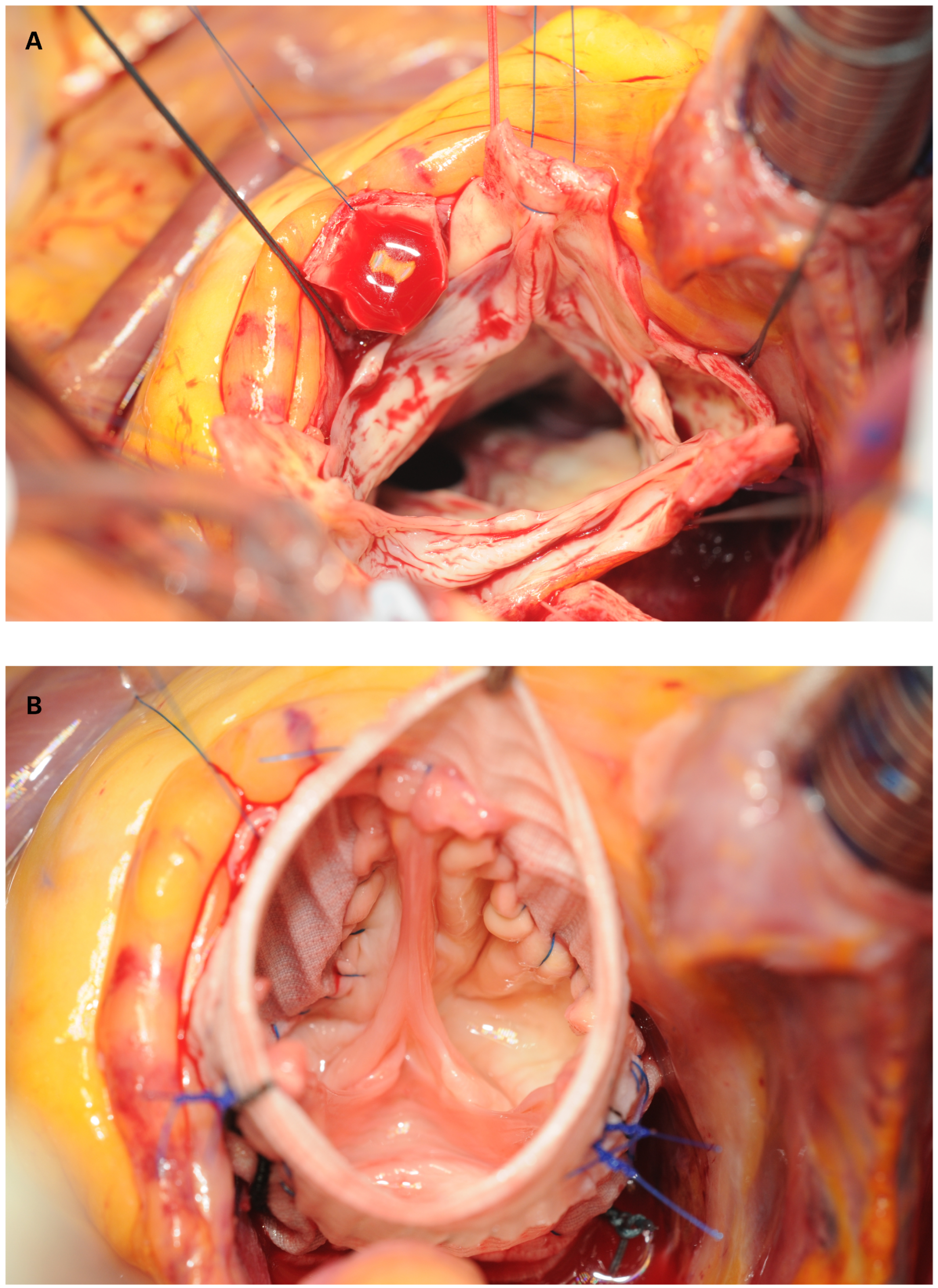Cardiovascmed 24 00001 g004