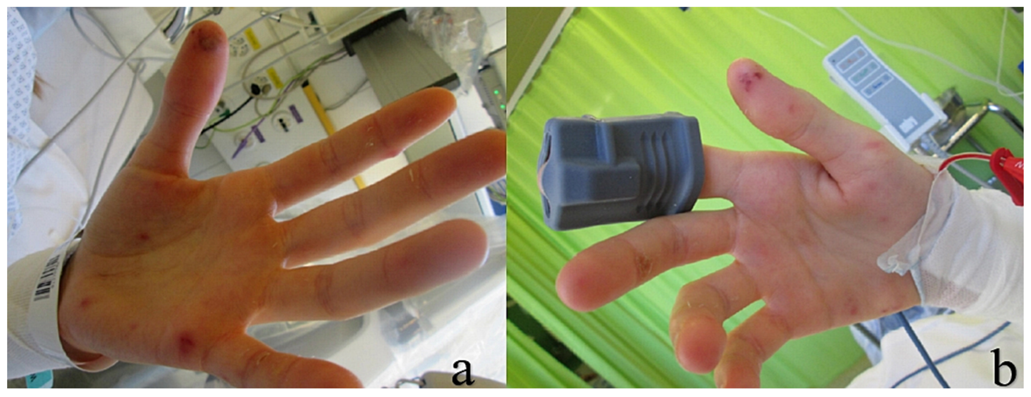 Cardiovascmed 24 00062 g001 Cardiovascmed 24 00062 g001