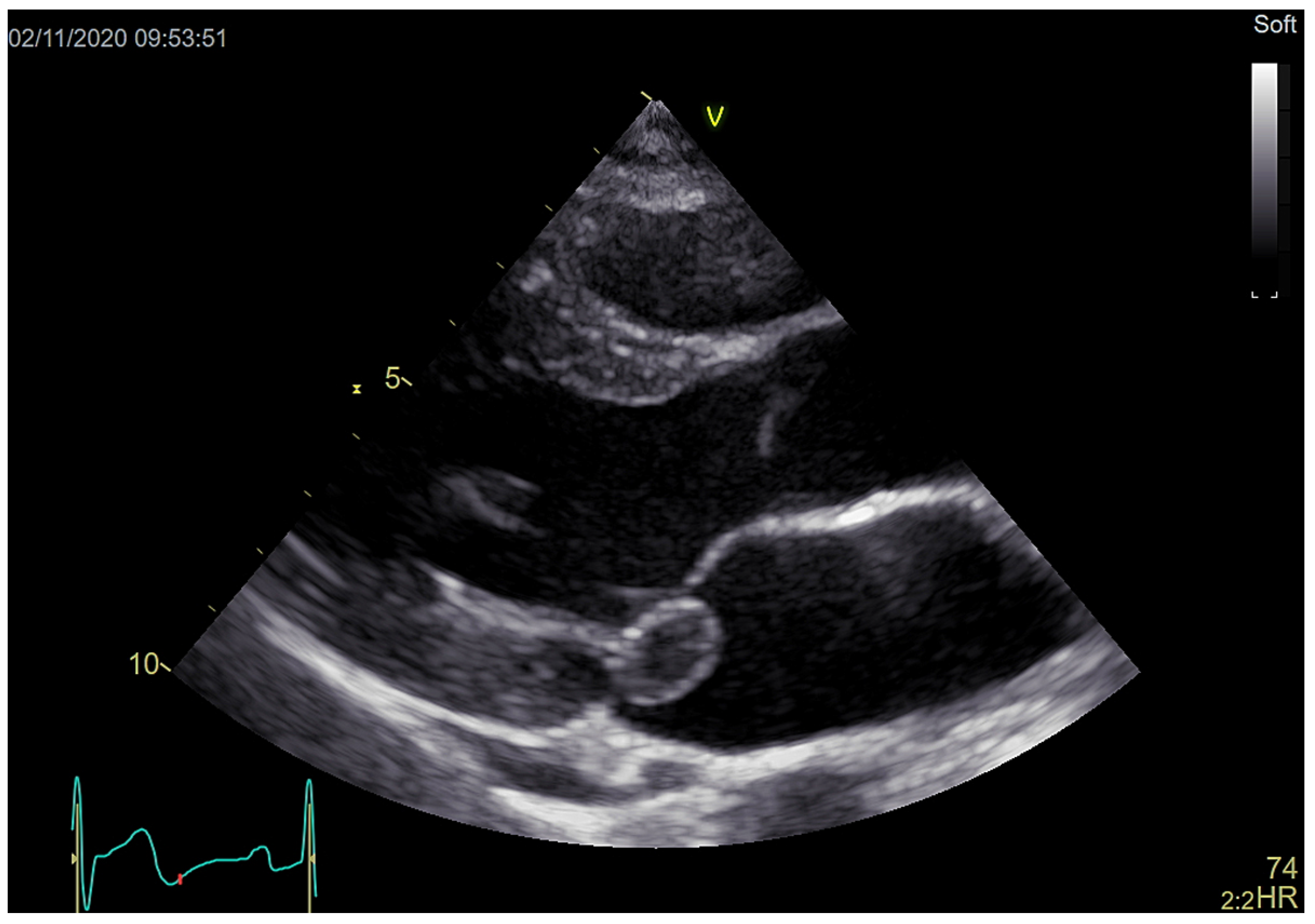 Cardiovascmed 24 00062 g002 Cardiovascmed 24 00062 g002