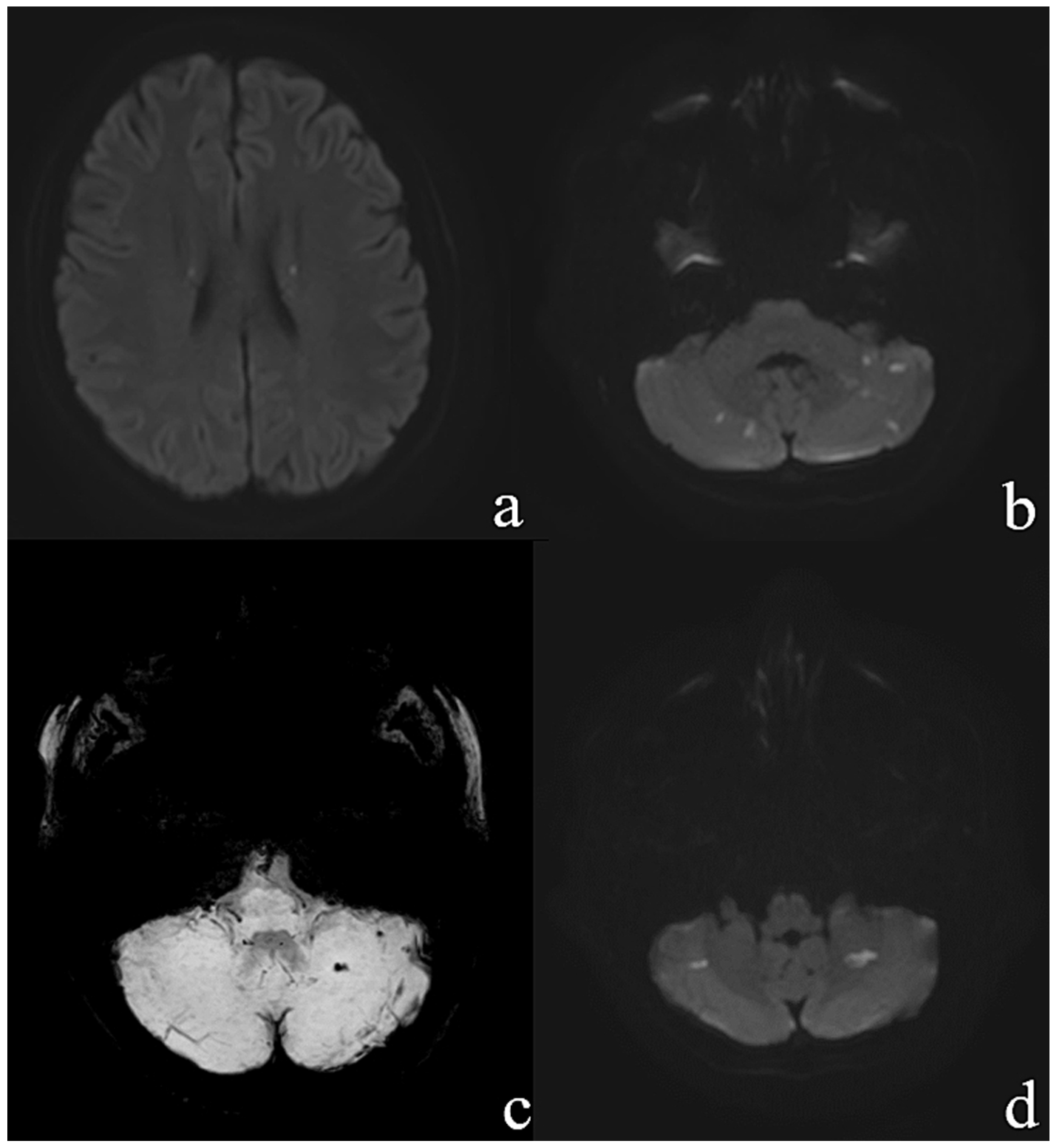 Cardiovascmed 24 00062 g003 Cardiovascmed 24 00062 g003