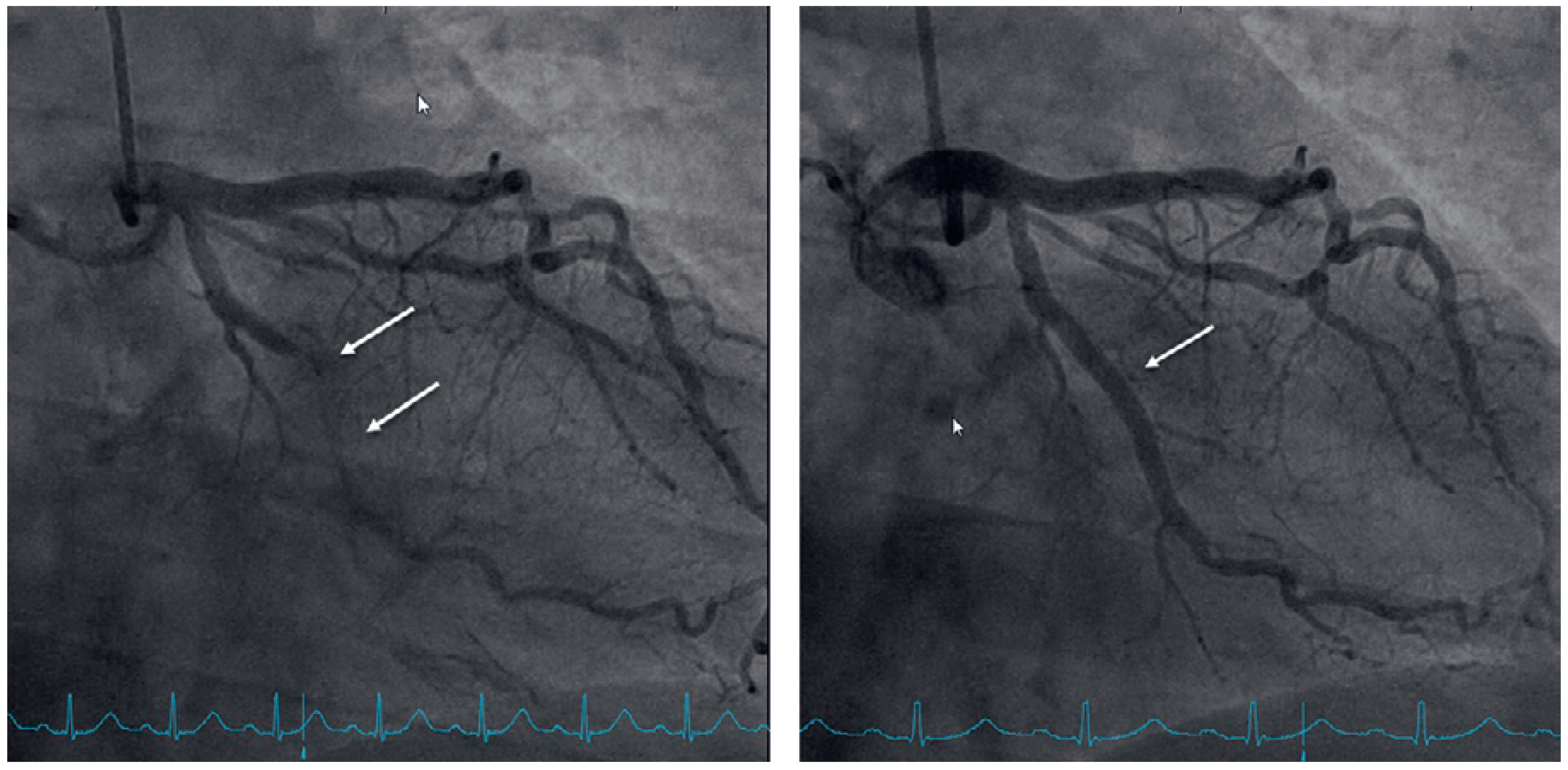 Cardiovascmed 24 00184 g003 Cardiovascmed 24 00184 g003