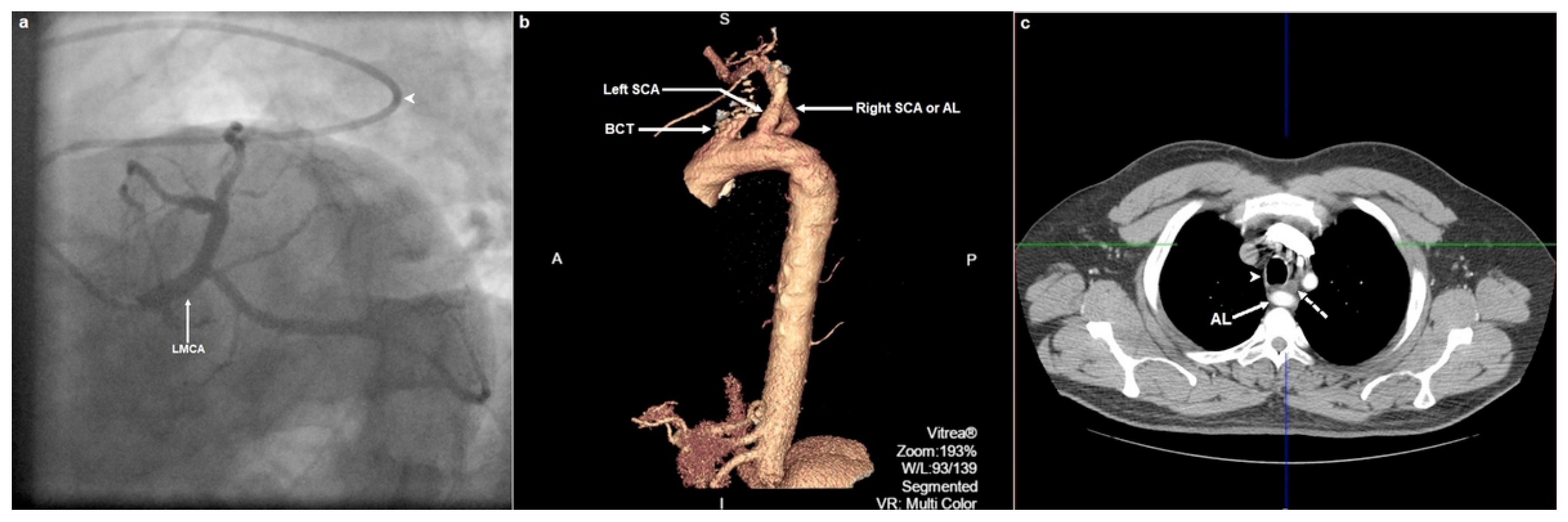 Cardiovascmed 24 10094 g001