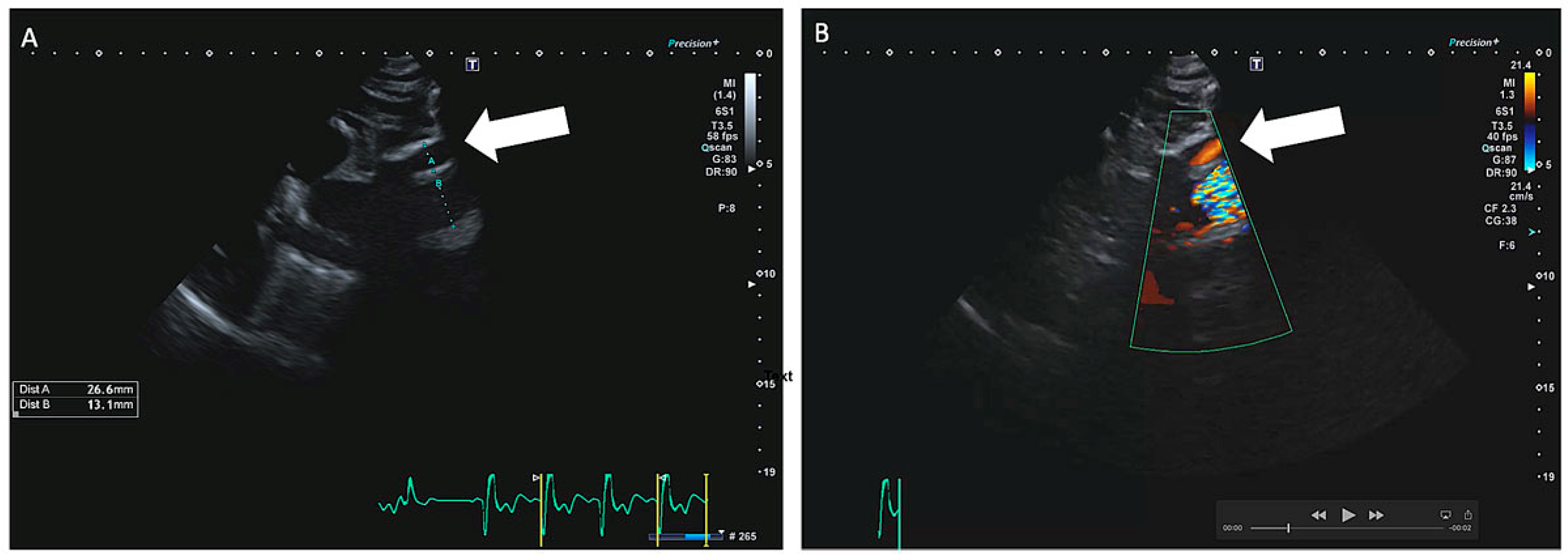 Cardiovascmed 24 w02135 g001