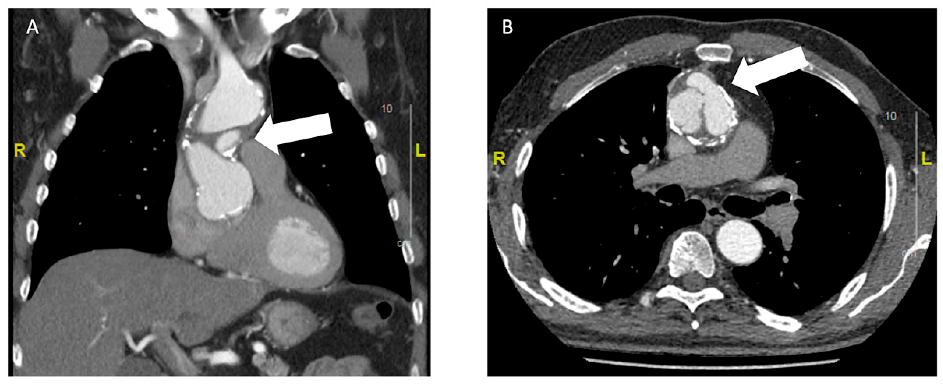 Cardiovascmed 24 w02135 g002
