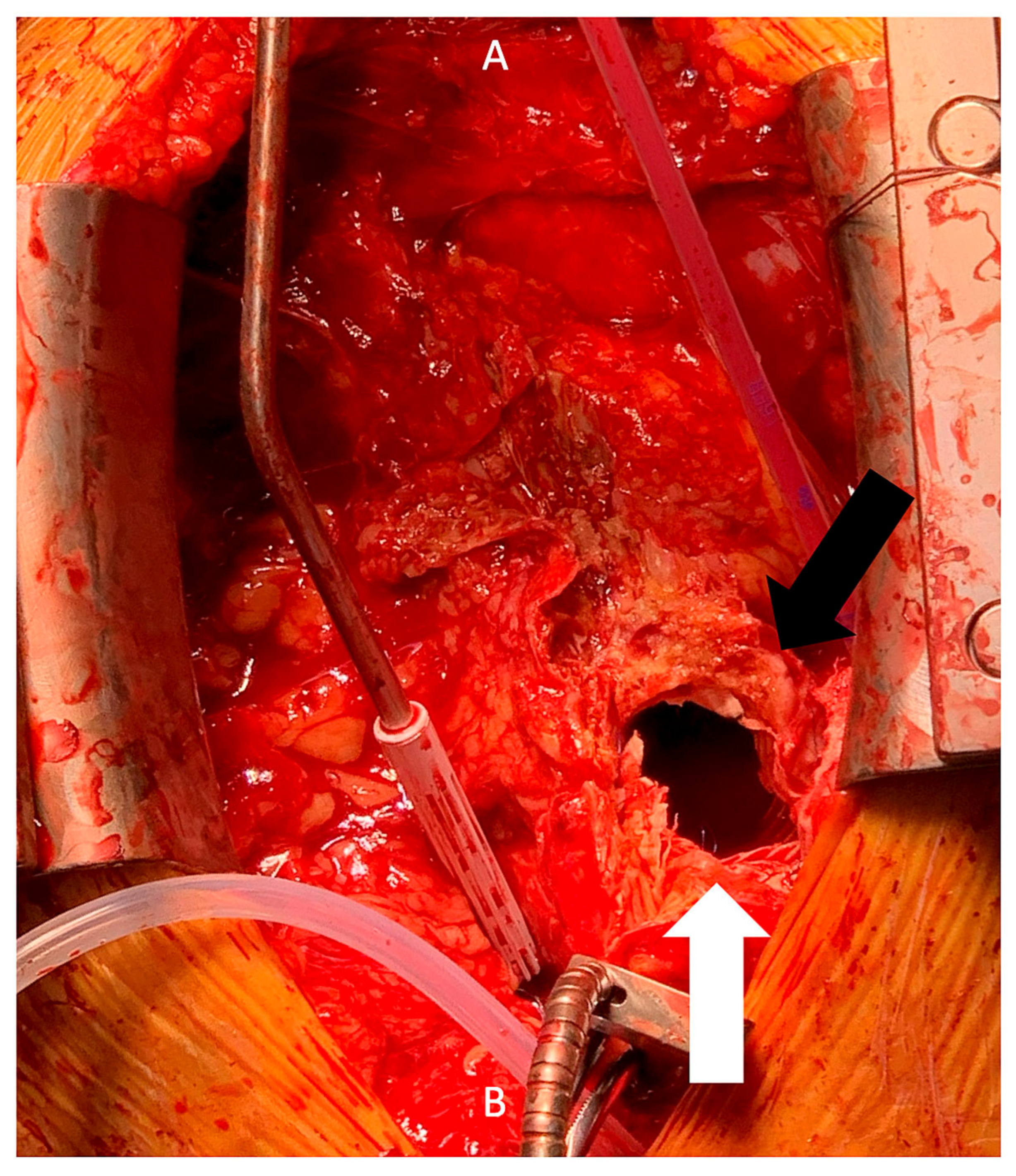 Cardiovascmed 24 w02135 g003