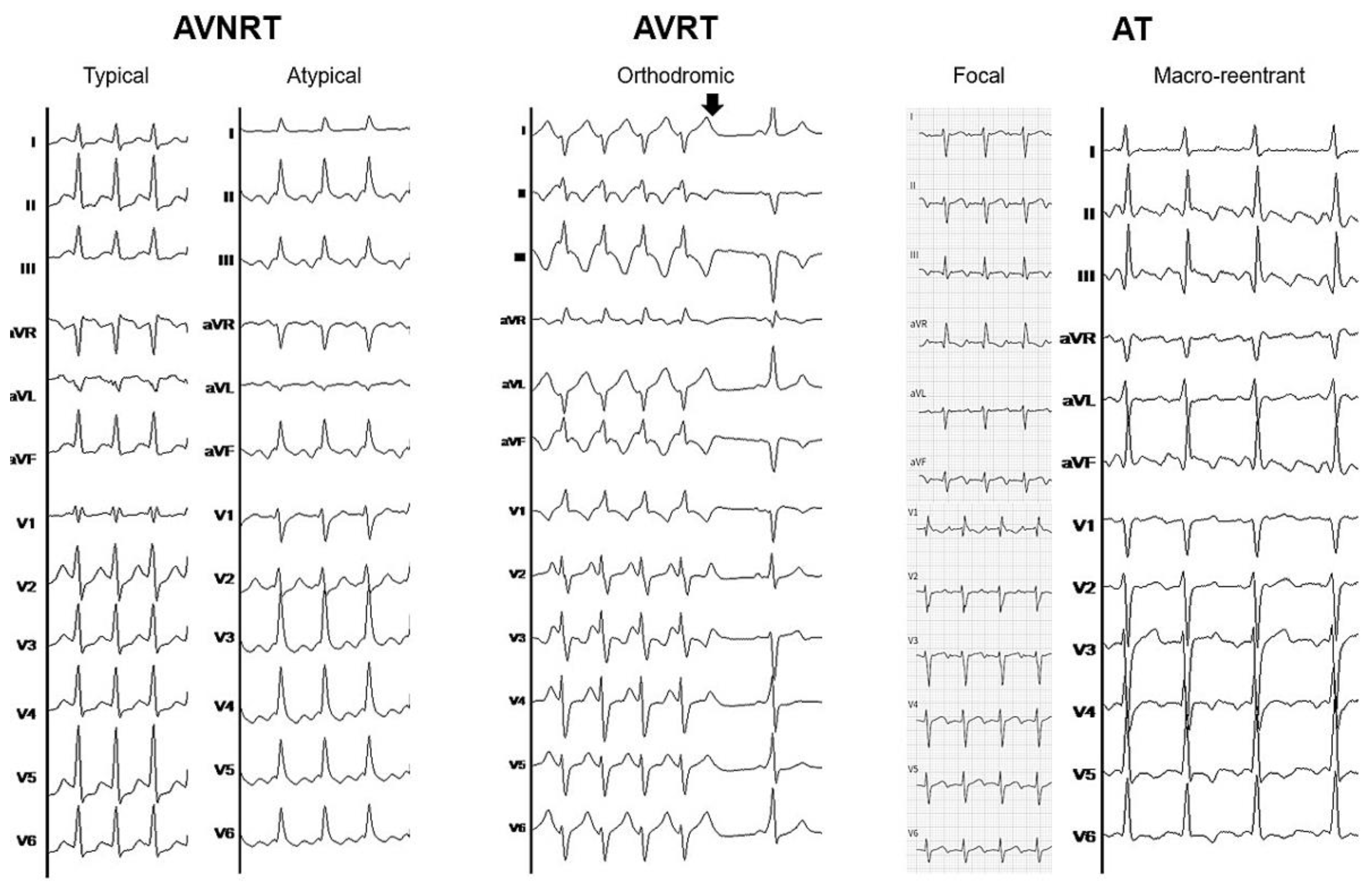 Cardiovascmed 24 w02167 g001