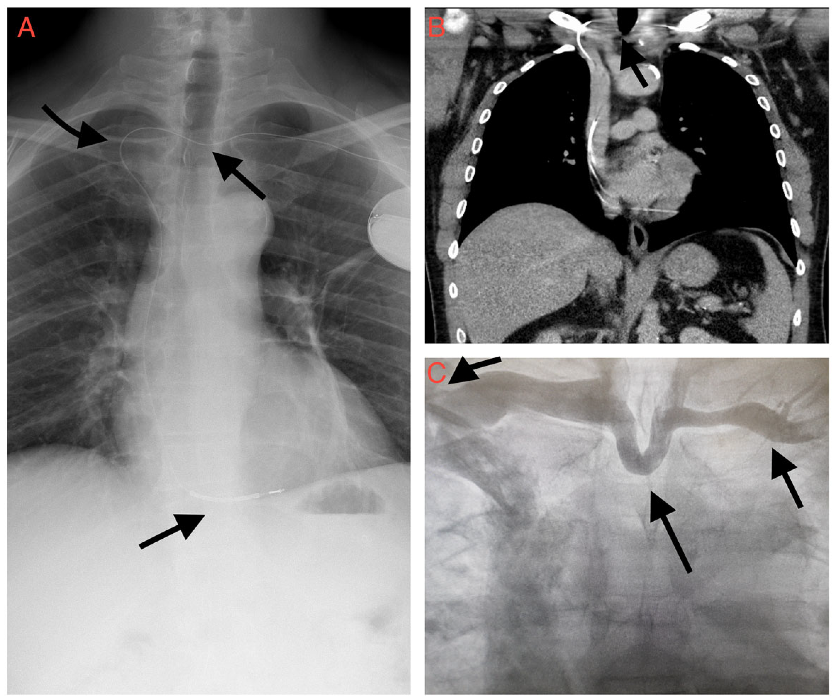 Cardiovascmed 24 w10047 g001 Cardiovascmed 24 w10047 g001