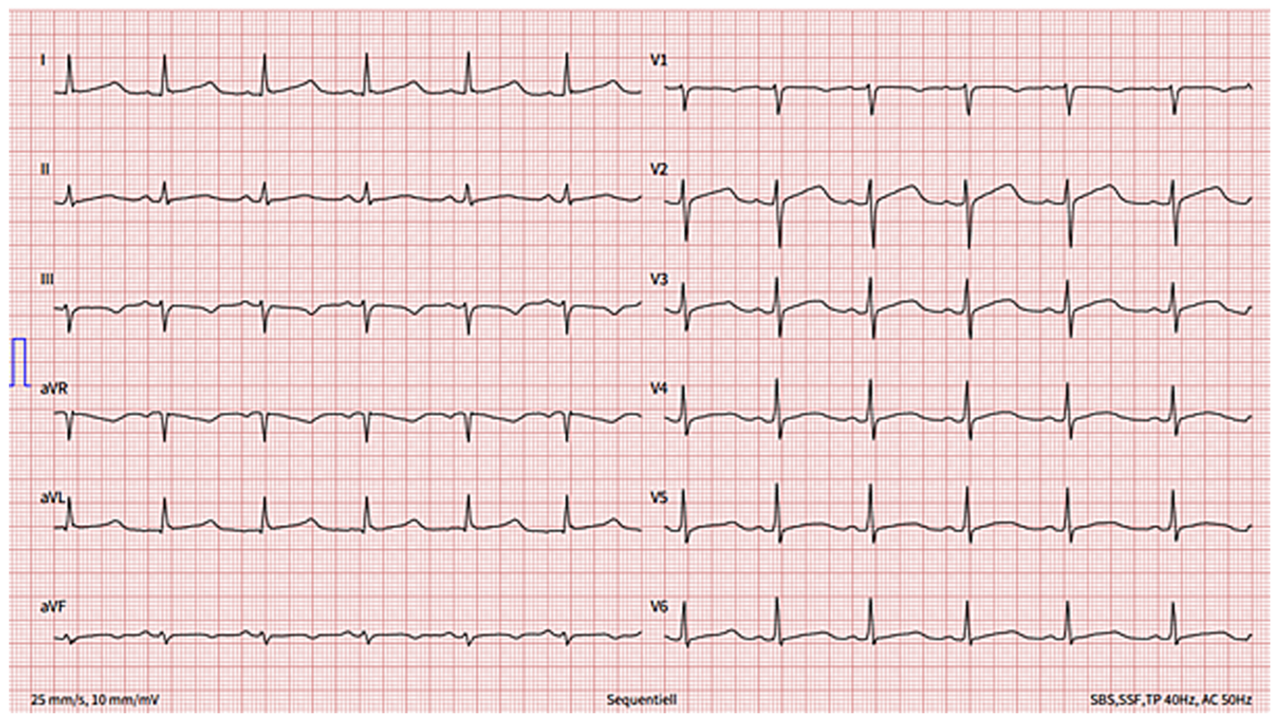 Cardiovascmed 24 w10064 g001