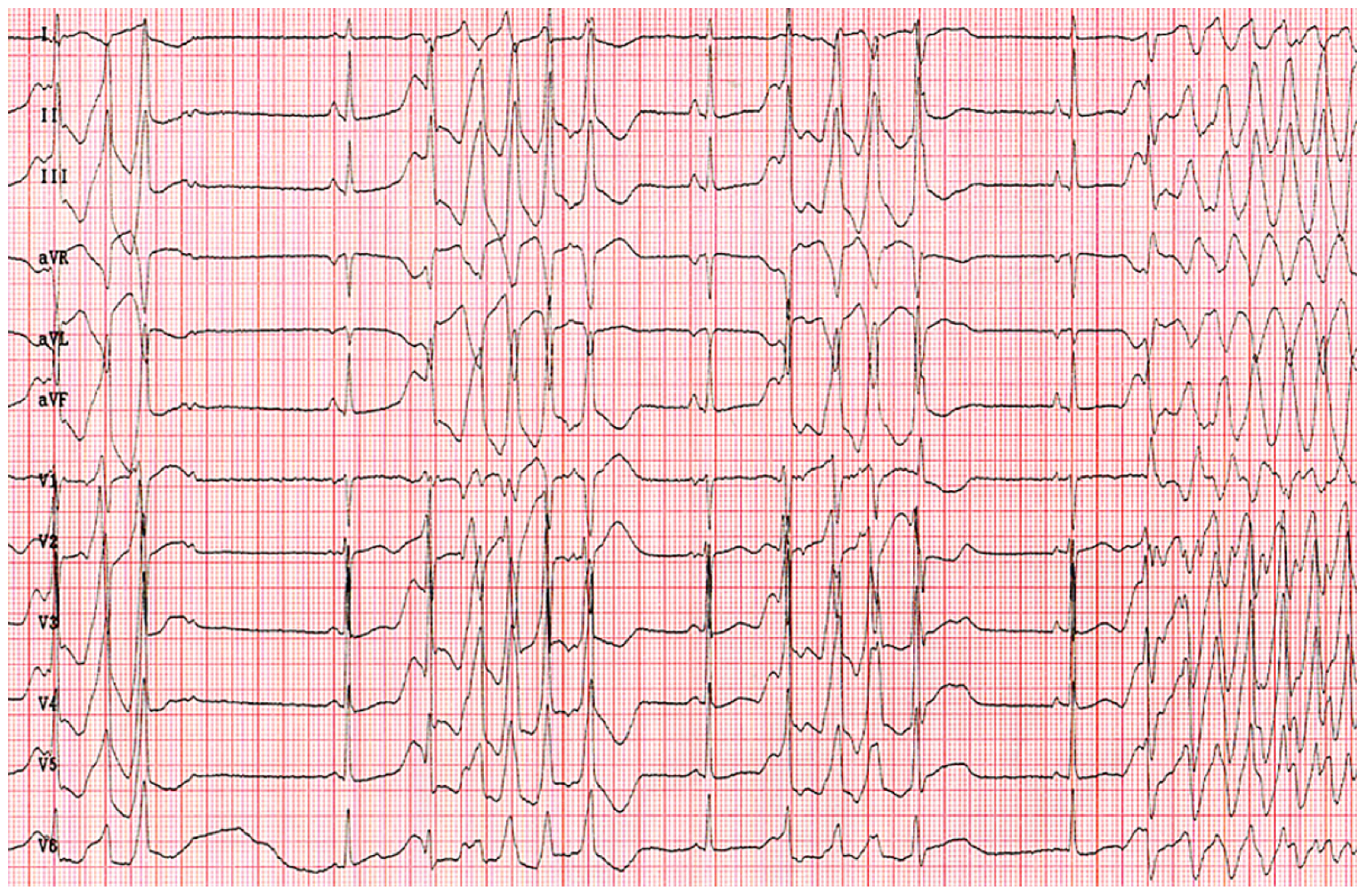 Cardiovascmed 24 w10064 g002