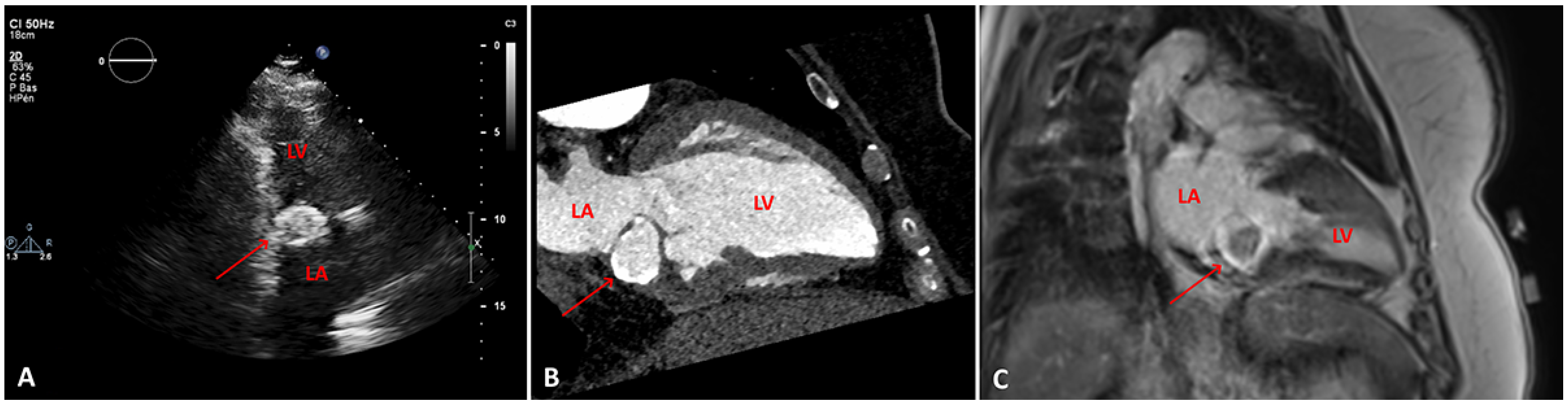 Cardiovascmed 24 w10088 g001