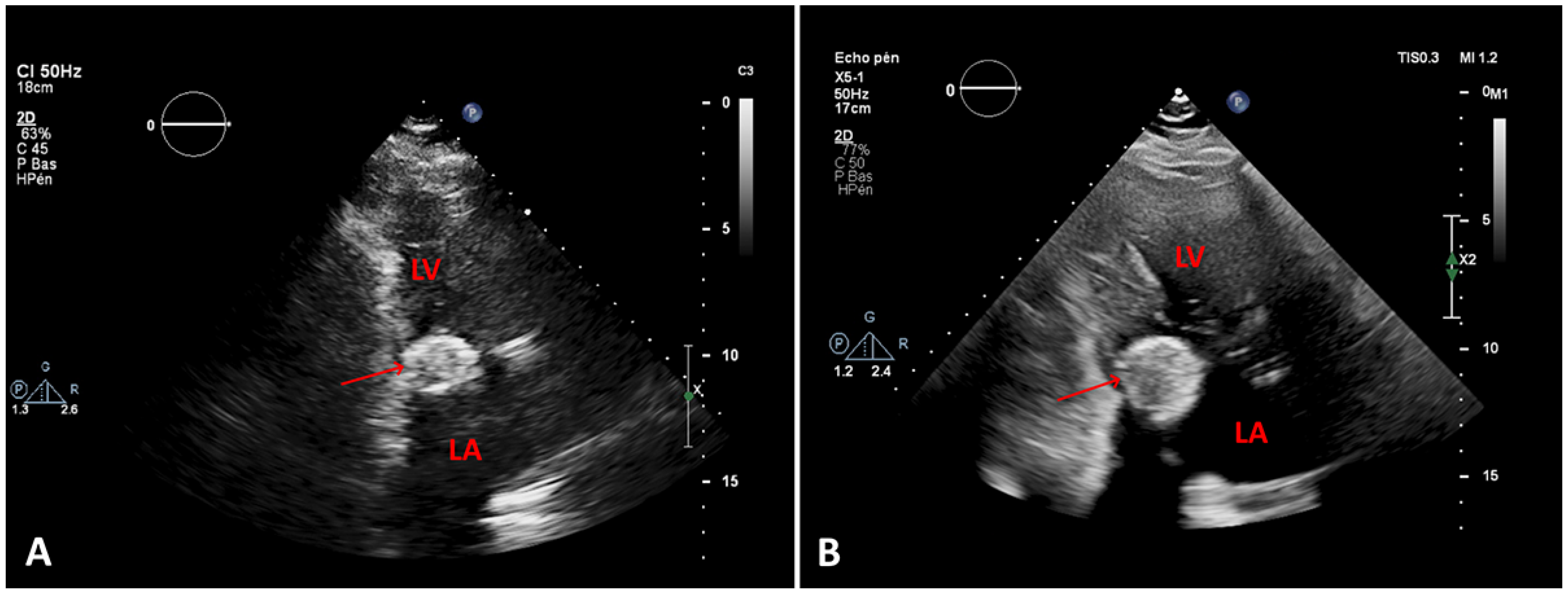 Cardiovascmed 24 w10088 g002