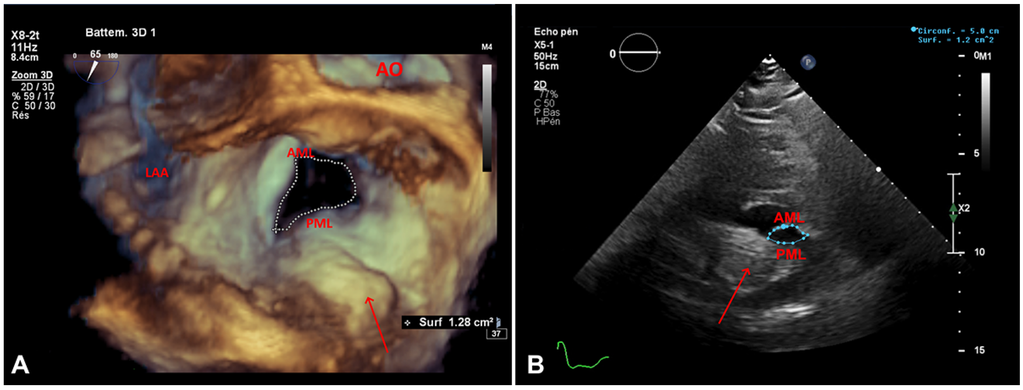 Cardiovascmed 24 w10088 g003