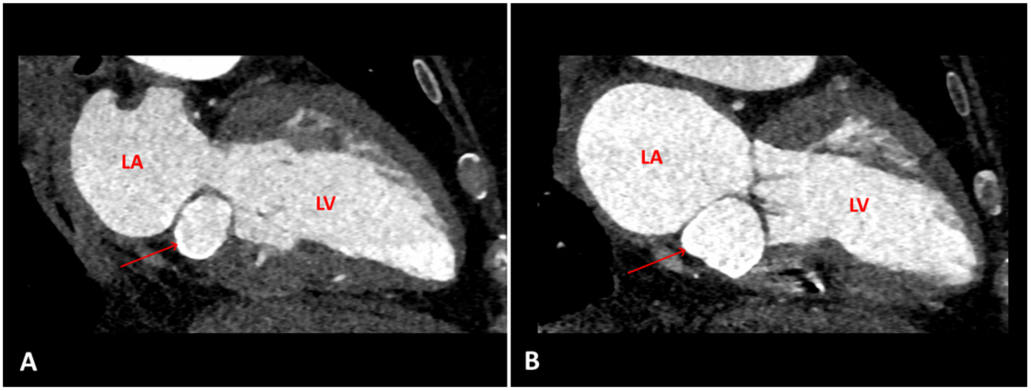 Cardiovascmed 24 w10088 g004
