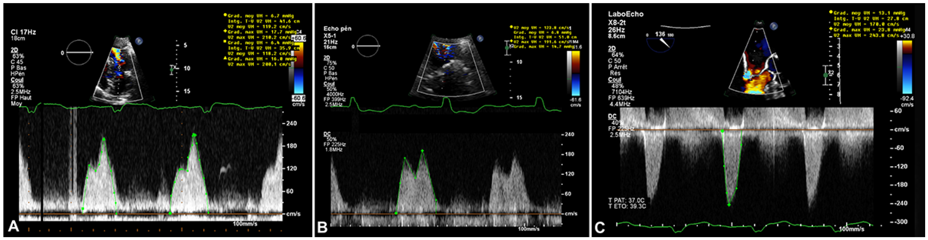 Cardiovascmed 24 w10088 g005