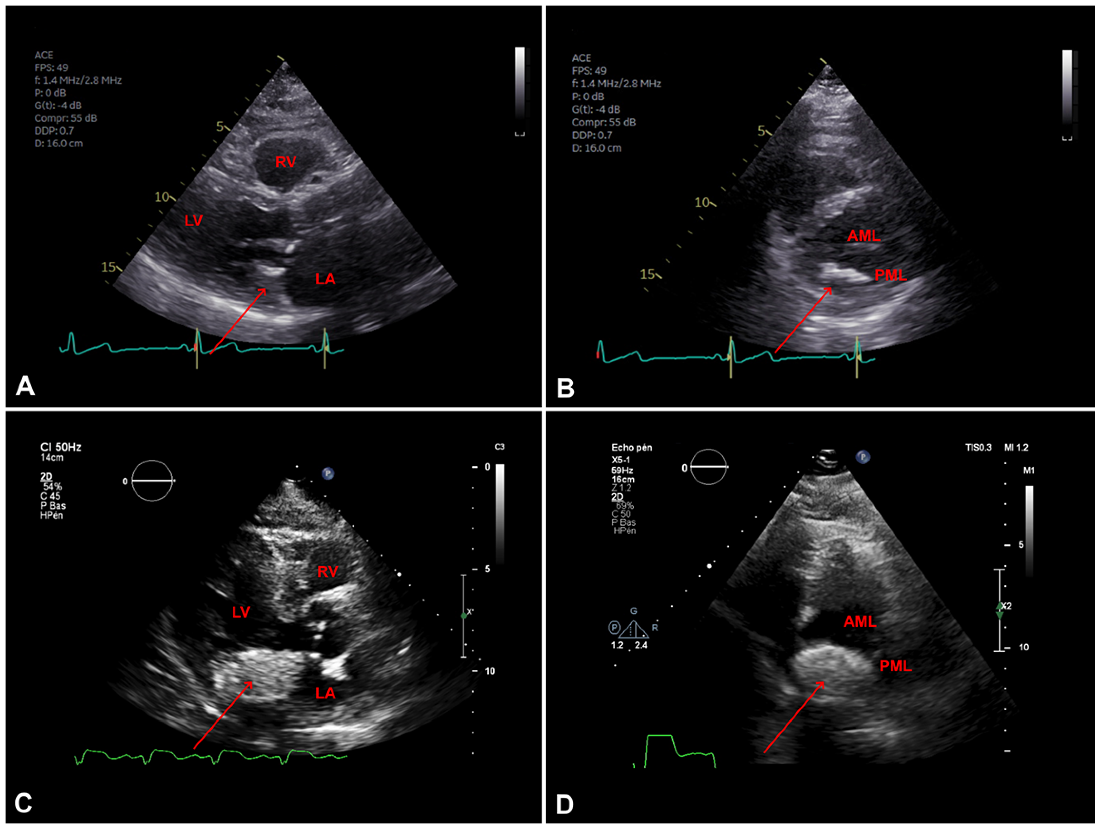Cardiovascmed 24 w10088 g006