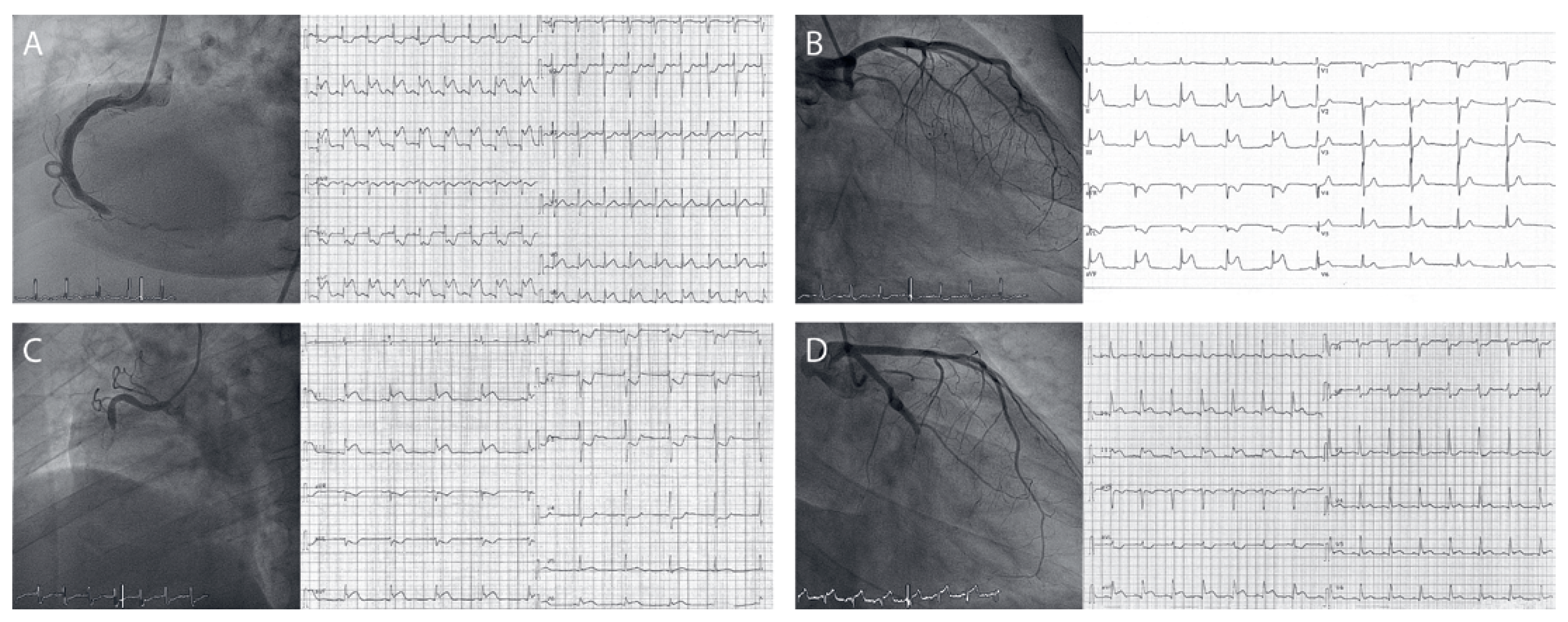Cardiovascmed 25 00018 g001