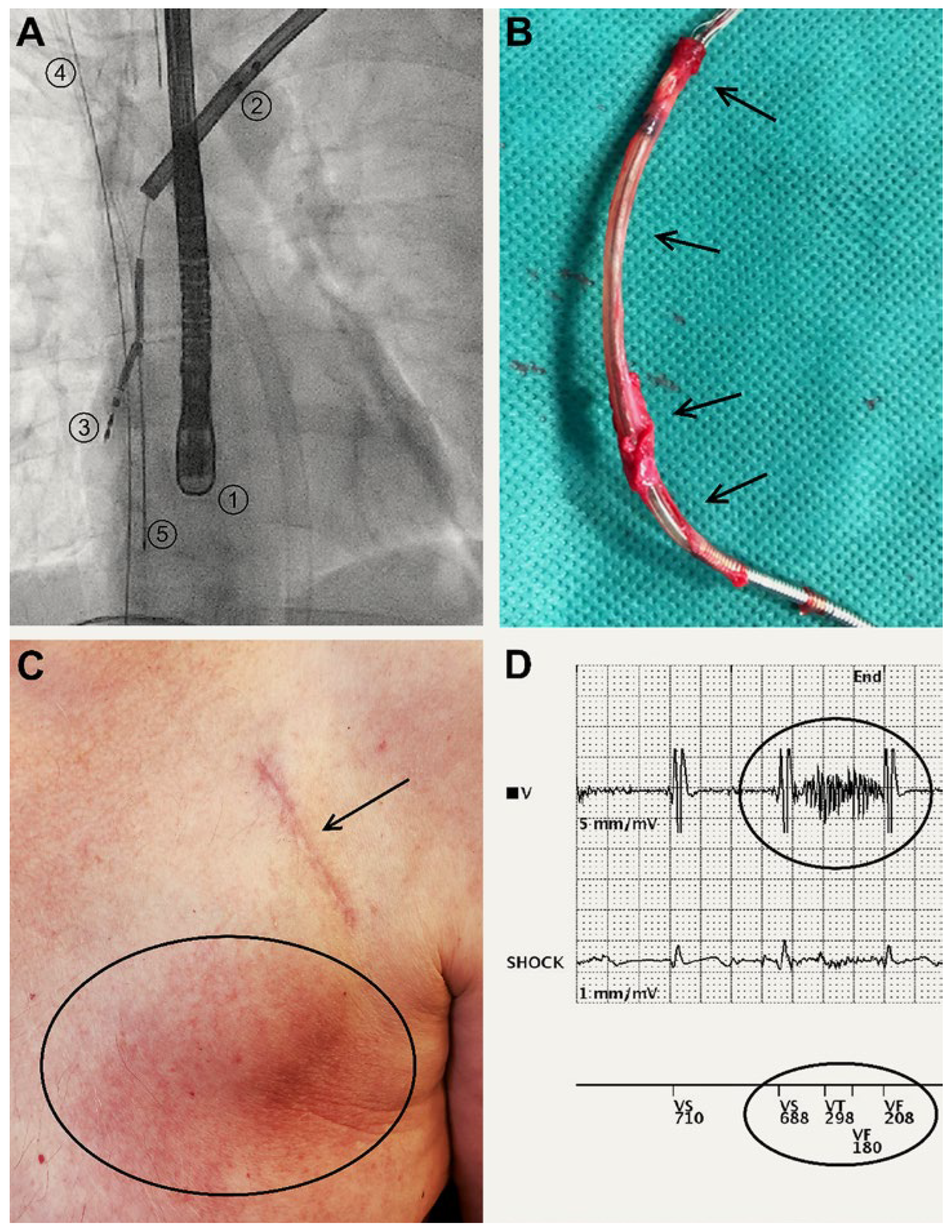 Cardiovascmed 25 00028 g003