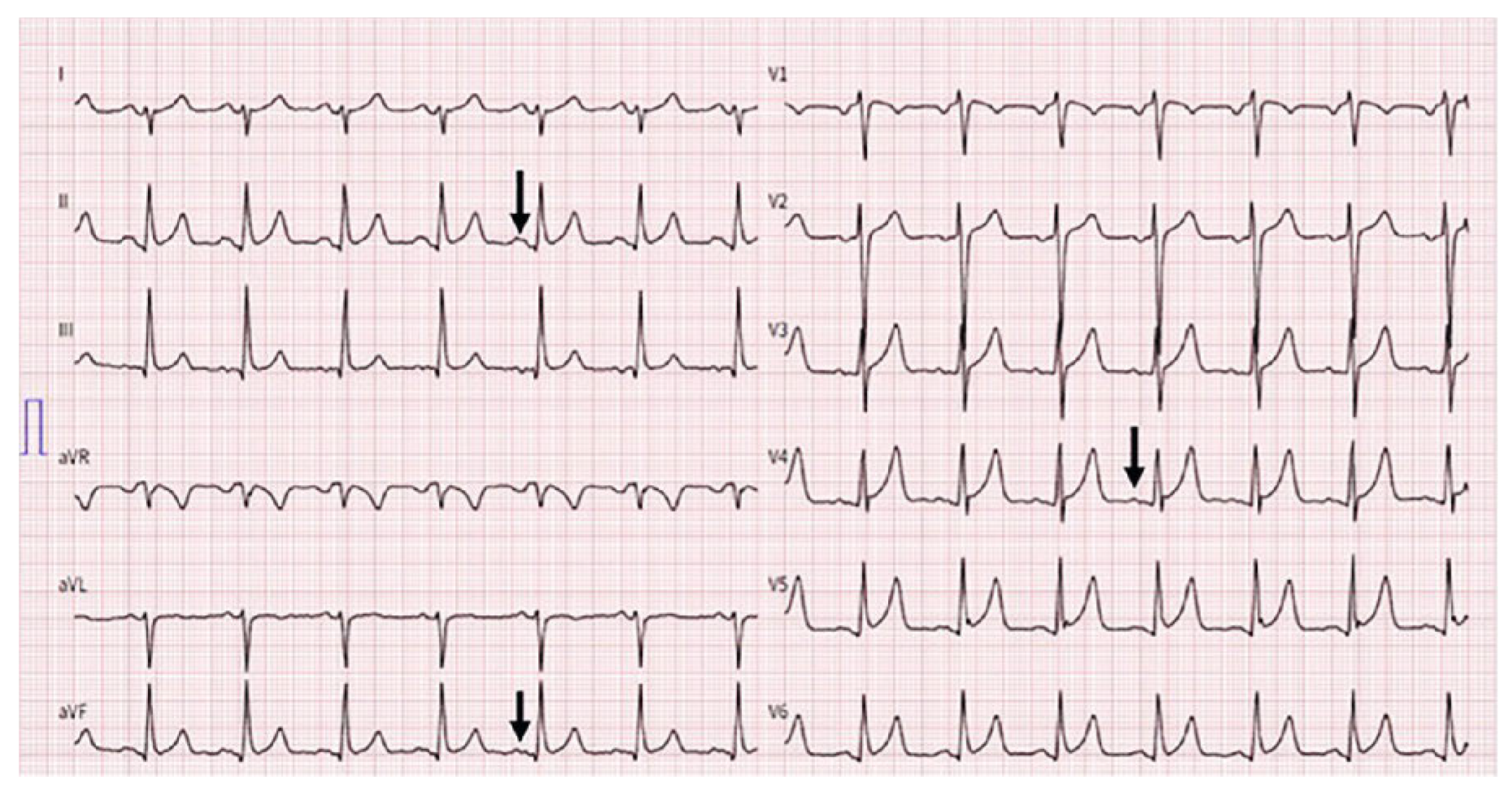 Cardiovascmed 25 00048 g001
