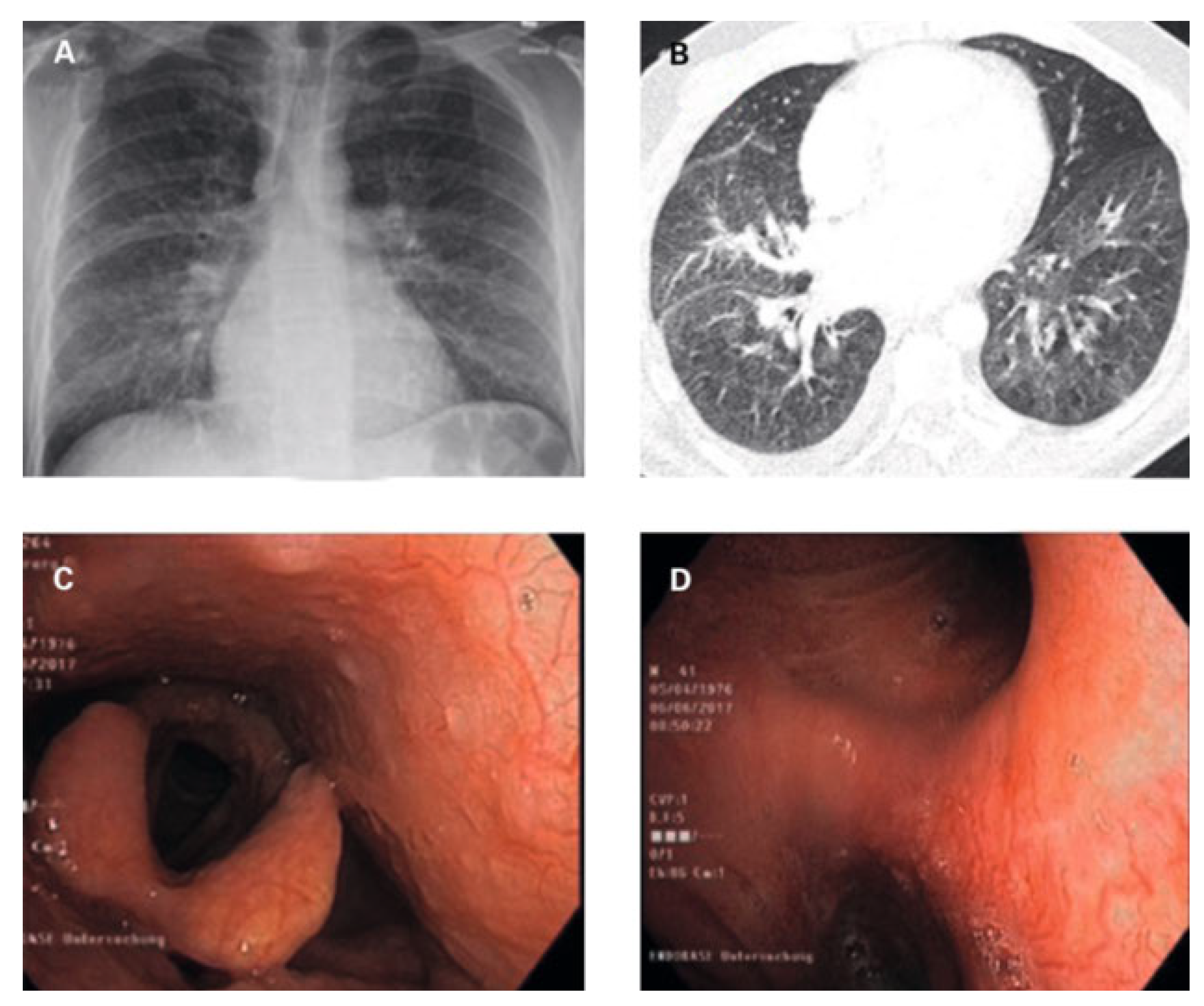 Cardiovascmed 25 00048 g002