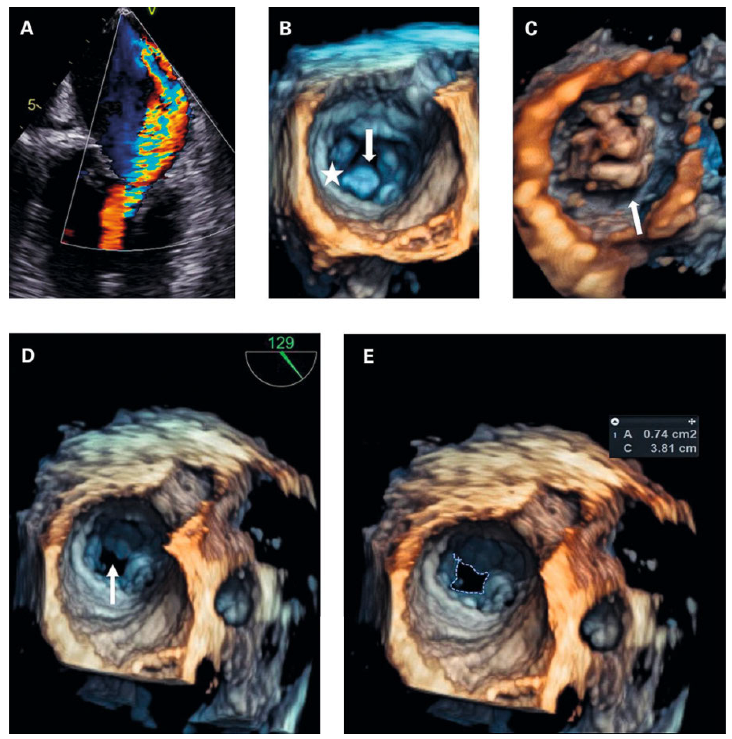 Cardiovascmed 25 00048 g004