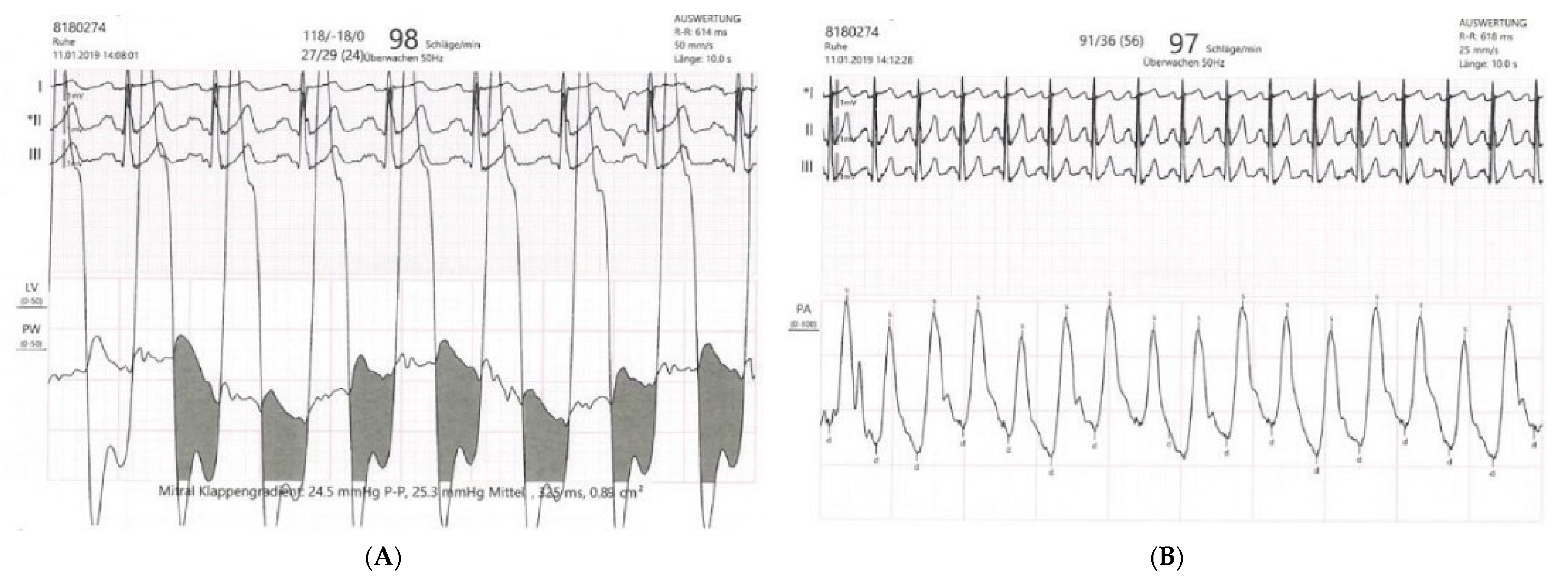 Cardiovascmed 25 00048 g005