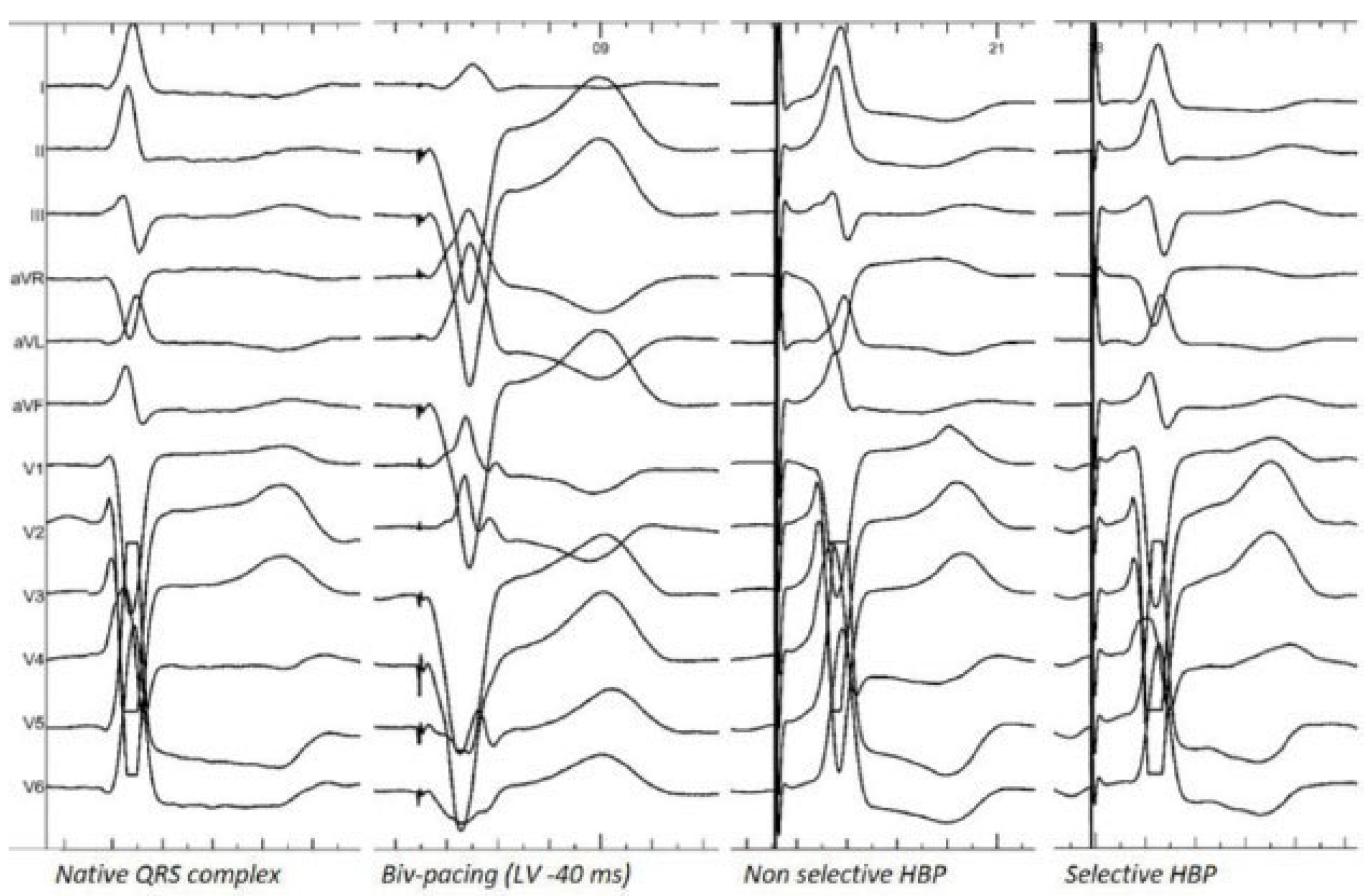 Cardiovascmed 25 00053 g002