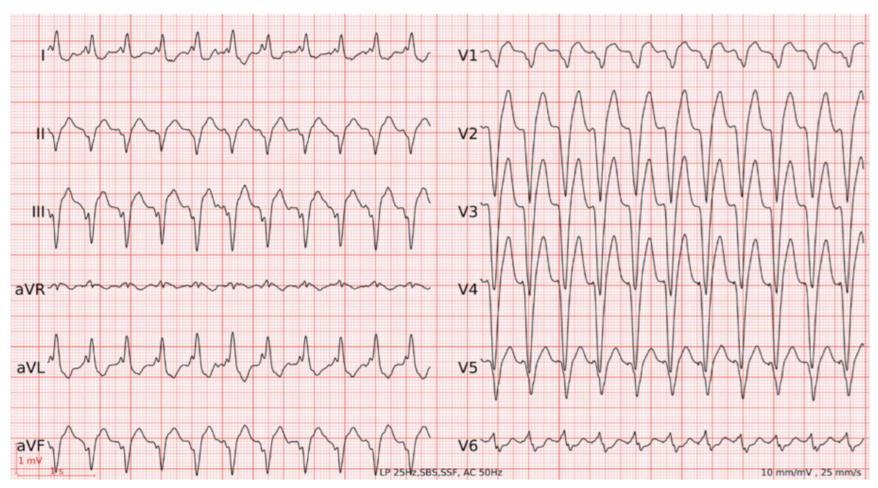 Cardiovascmed 25 00056 g001