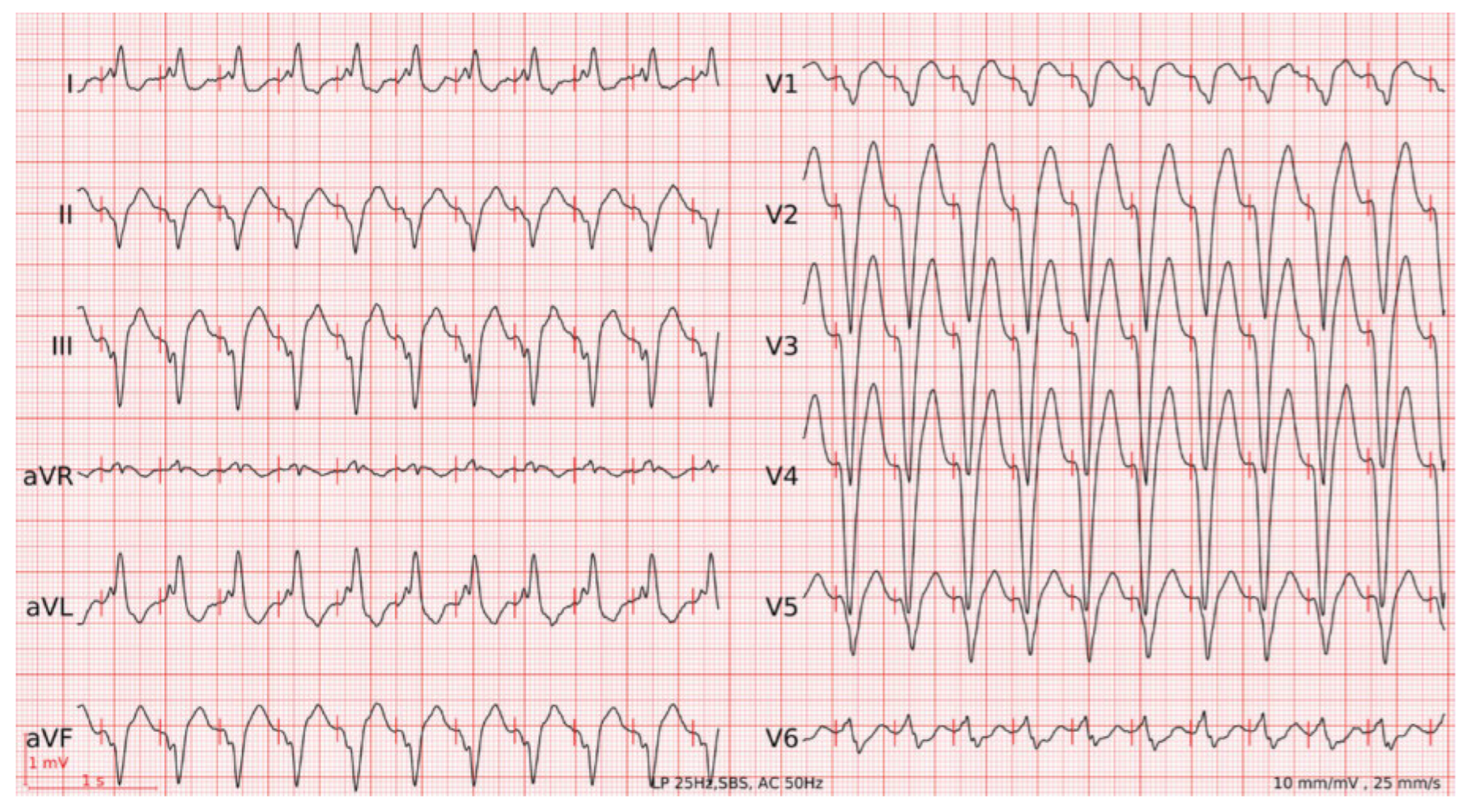 Cardiovascmed 25 00056 g002