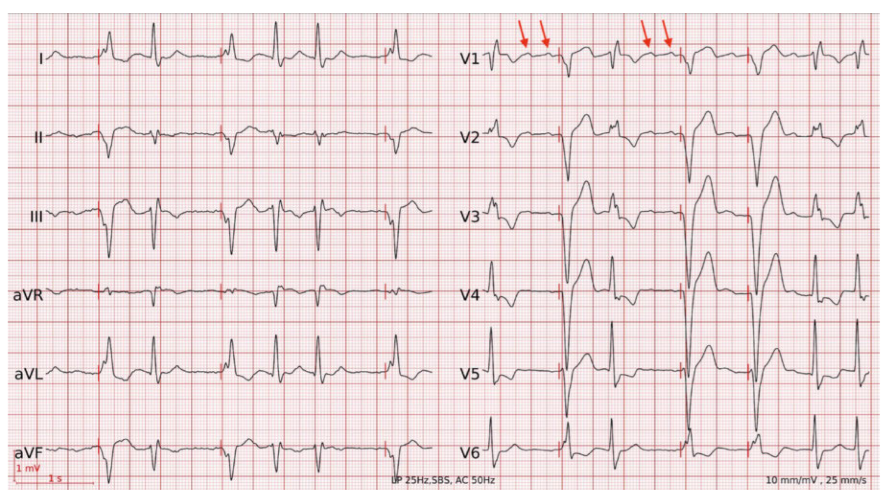 Cardiovascmed 25 00056 g003