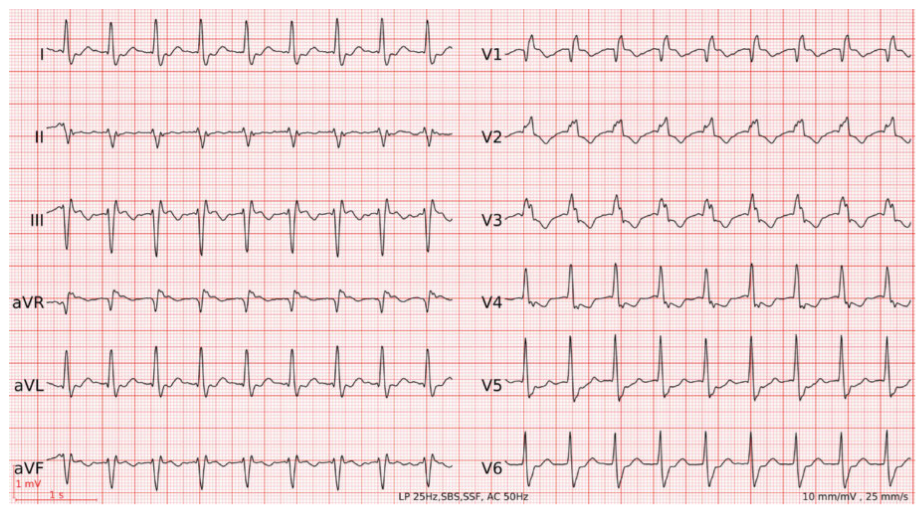 Cardiovascmed 25 00056 g004